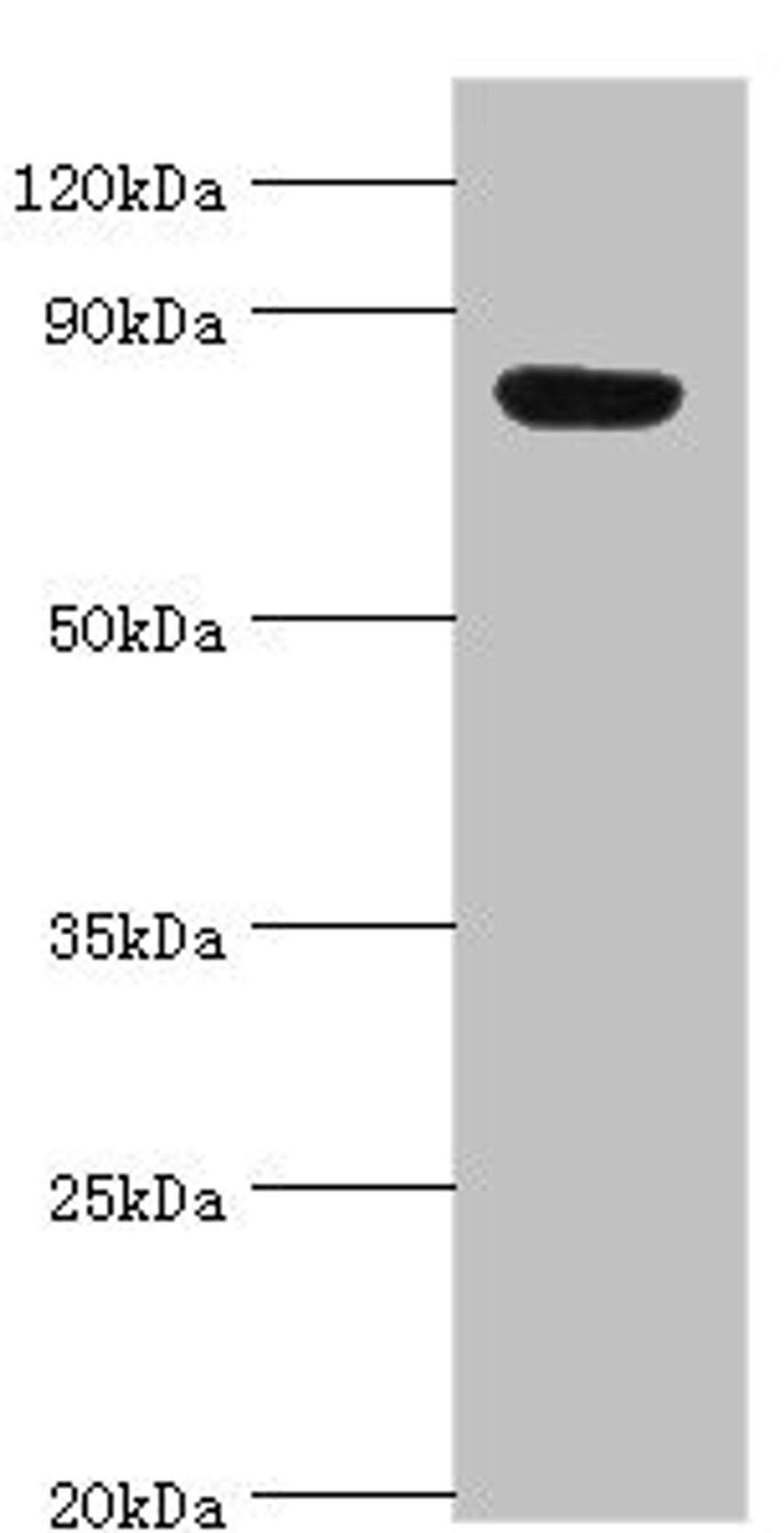Western blot. All lanes: Aryl hydrocarbon receptor nuclear translocator 2 antibody at 4ug/ml + Hela whole cell lysate. Secondary. Goat polyclonal to rabbit IgG at 1/10000 dilution. Predicted band size: 79, 78 kDa. Observed band size: 79 kDa. 