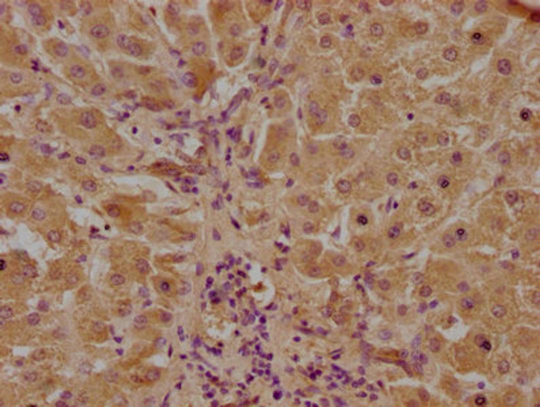 IHC image of CSB-PA811601LA01HU diluted at 1:100 and staining in paraffin-embedded human liver tissue performed on a Leica BondTM system. After dewaxing and hydration, antigen retrieval was mediated by high pressure in a citrate buffer (pH 6.0). Section was blocked with 10% normal goat serum 30min at RT. Then primary antibody (1% BSA) was incubated at 4°C overnight. The primary is detected by a biotinylated secondary antibody and visualized using an HRP conjugated SP system.