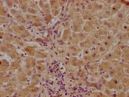 IHC image of CSB-PA811601LA01HU diluted at 1:100 and staining in paraffin-embedded human liver tissue performed on a Leica BondTM system. After dewaxing and hydration, antigen retrieval was mediated by high pressure in a citrate buffer (pH 6.0). Section was blocked with 10% normal goat serum 30min at RT. Then primary antibody (1% BSA) was incubated at 4°C overnight. The primary is detected by a biotinylated secondary antibody and visualized using an HRP conjugated SP system.