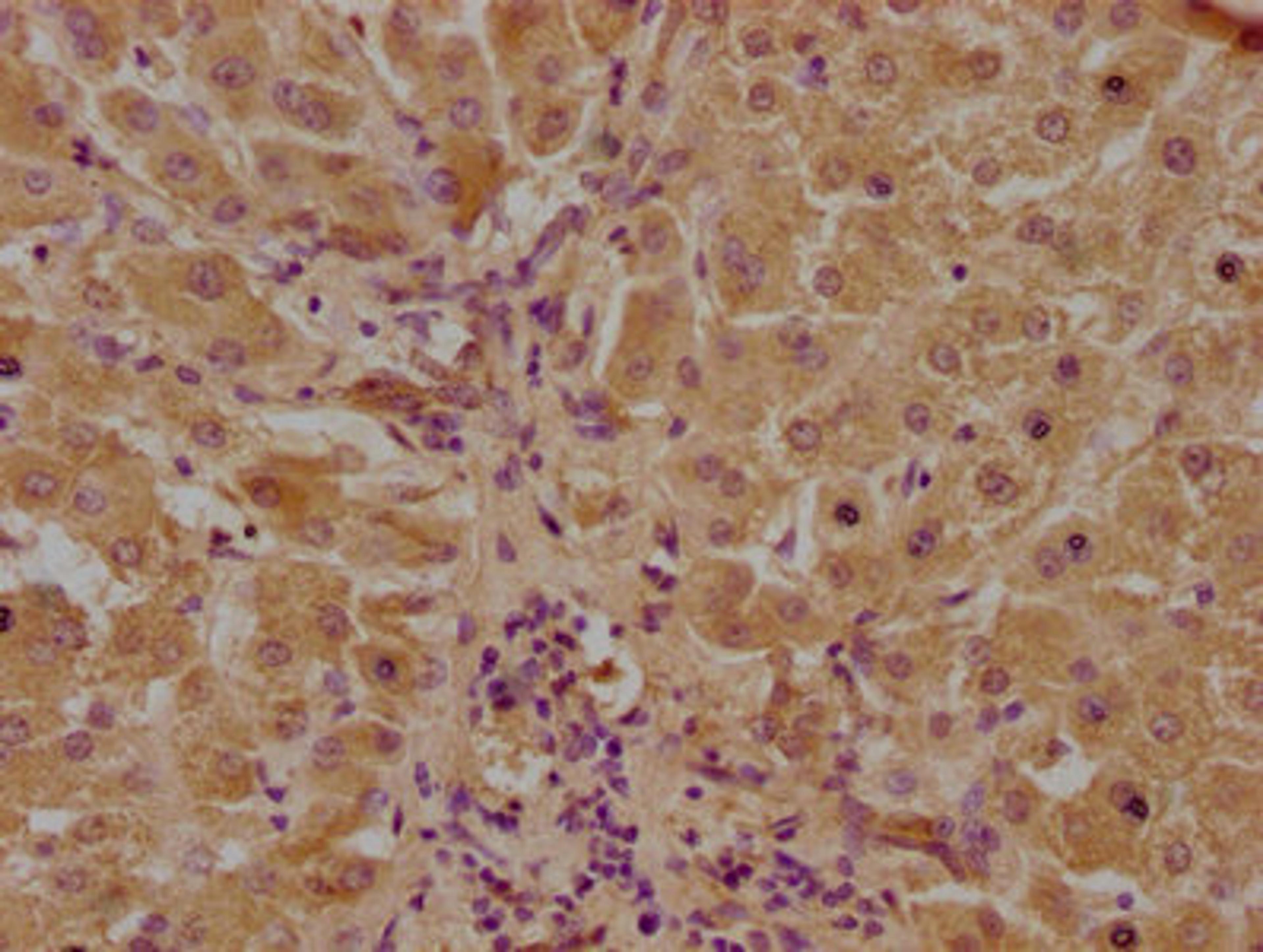 IHC image of CSB-PA811601LA01HU diluted at 1:100 and staining in paraffin-embedded human liver tissue performed on a Leica BondTM system. After dewaxing and hydration, antigen retrieval was mediated by high pressure in a citrate buffer (pH 6.0). Section was blocked with 10% normal goat serum 30min at RT. Then primary antibody (1% BSA) was incubated at 4°C overnight. The primary is detected by a biotinylated secondary antibody and visualized using an HRP conjugated SP system.