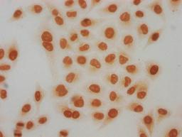 Immunocytochemistry analysis of CSB-PA010429PA91acHU diluted at 1:50 and staining in Hela cells(treated with 30mM sodium butyrate for 4h) performed on a Leica BondTM system. The cells were fixed in 4% formaldehyde, permeabilized using 0.2% Triton X-100 and blocked with 10% normal goat serum 30min at RT. Then primary antibody (1% BSA) was incubated at 4°C overnight. The primary is detected by a biotinylated secondary antibody and visualized using an HRP conjugated SP system.