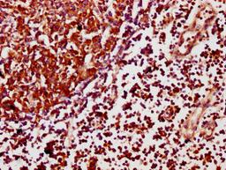 IHC image of CSB-PA754405LA01HU diluted at 1:500 and staining in paraffin-embedded human lymph node tissue performed on a Leica BondTM system. After dewaxing and hydration, antigen retrieval was mediated by high pressure in a citrate buffer (pH 6.0). Section was blocked with 10% normal goat serum 30min at RT. Then primary antibody (1% BSA) was incubated at 4&deg;C overnight. The primary is detected by a biotinylated secondary antibody and visualized using an HRP conjugated SP system.