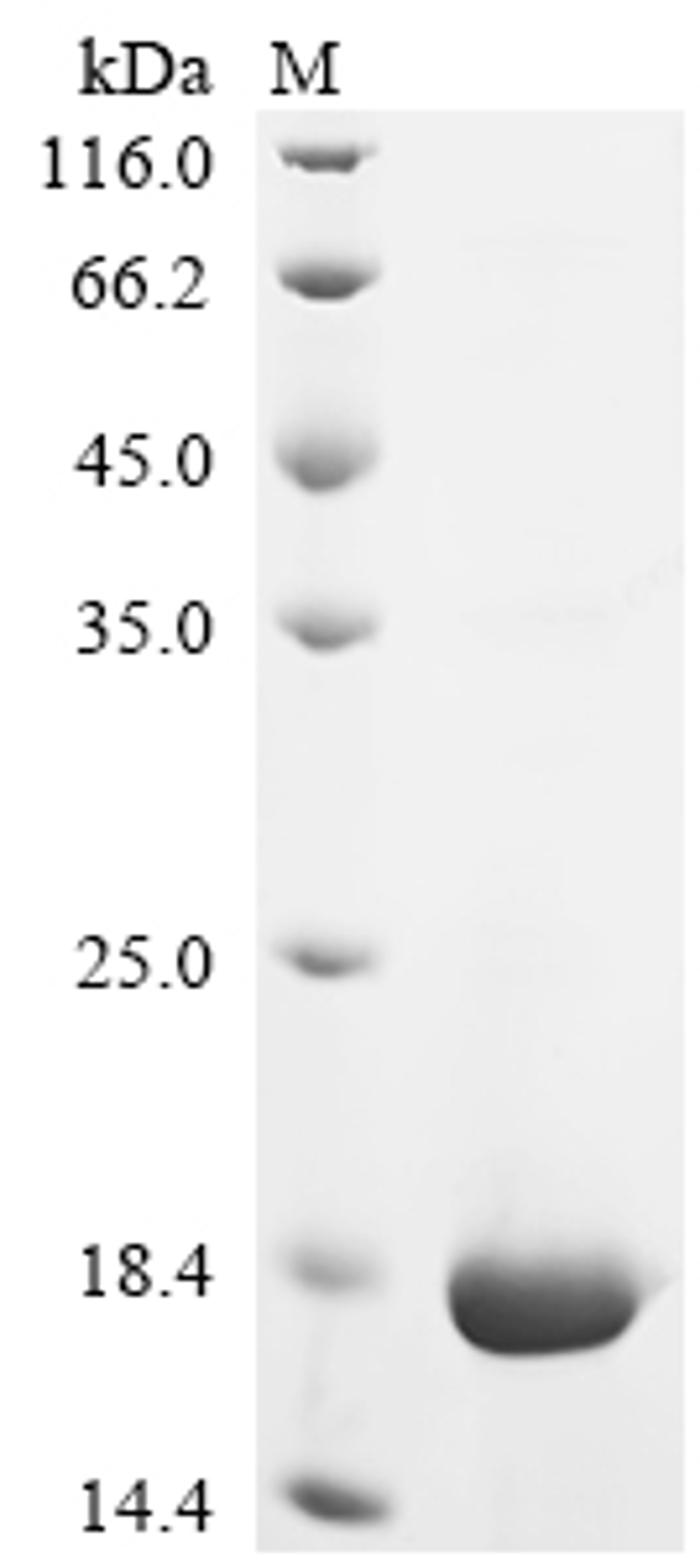 (Tris-Glycine gel) Discontinuous SDS-PAGE (reduced) with 5% enrichment gel and 15% separation gel.