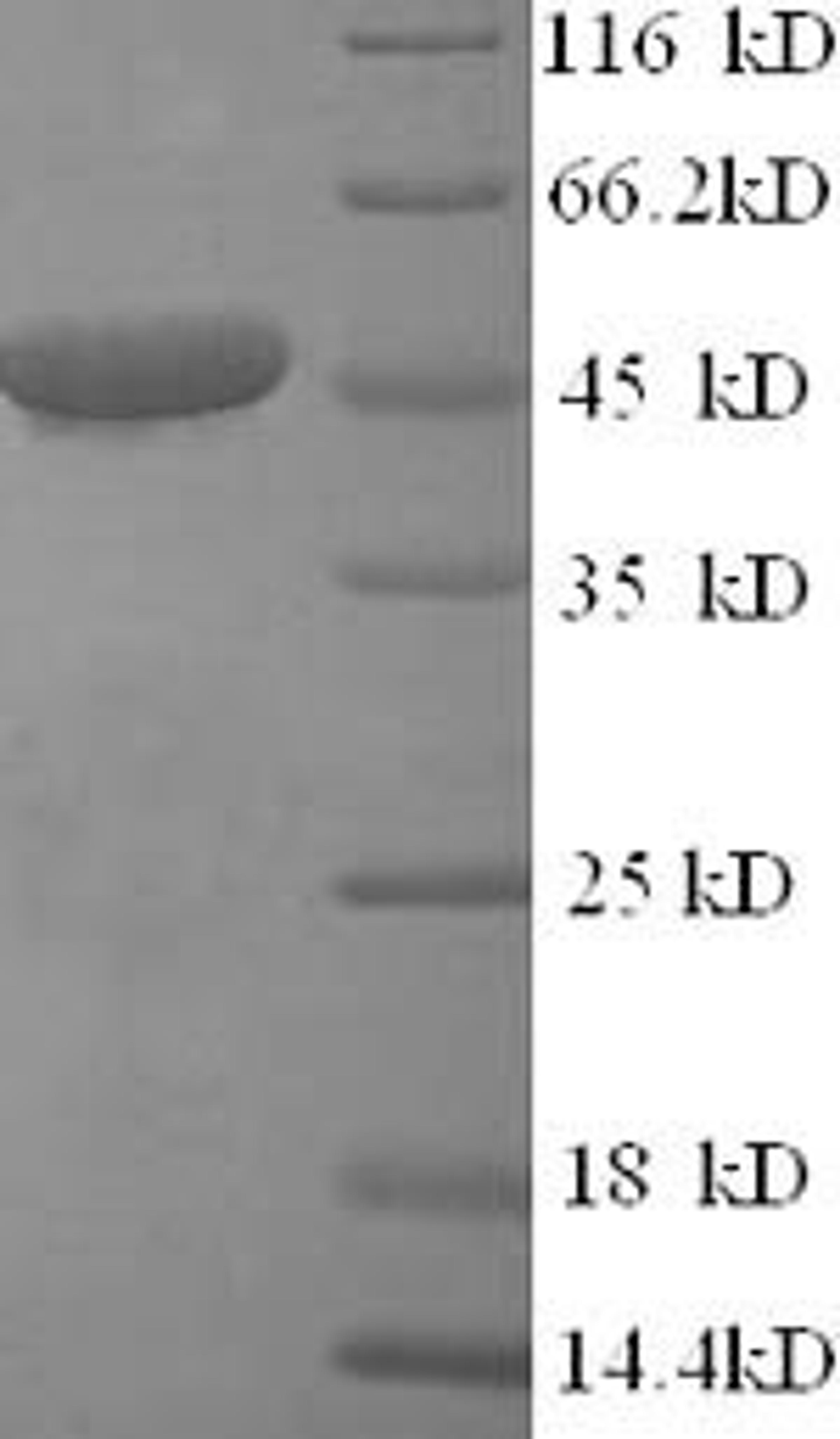 (Tris-Glycine gel) Discontinuous SDS-PAGE (reduced) with 5% enrichment gel and 15% separation gel.