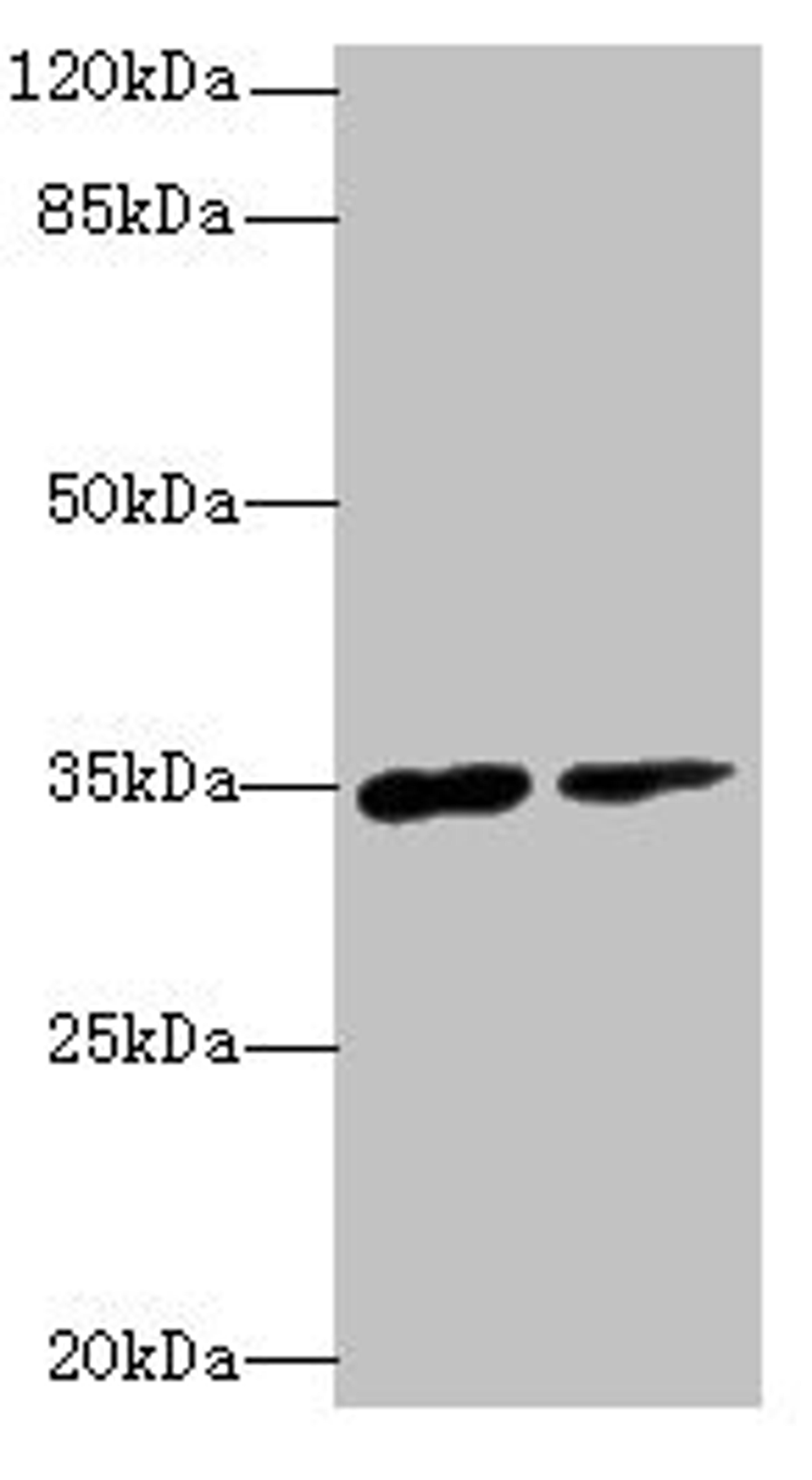 Western blot. All lanes: RNF148 antibody at 6µg/ml. Lane 1: Hela whole cell lysate. Lane 2: HepG2 whole cell lysate. Secondary. Goat polyclonal to rabbit IgG at 1/10000 dilution. Predicted band size: 35 kDa. Observed band size: 35 kDa