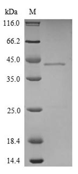 (Tris-Glycine gel) Discontinuous SDS-PAGE (reduced) with 5% enrichment gel and 15% separation gel.