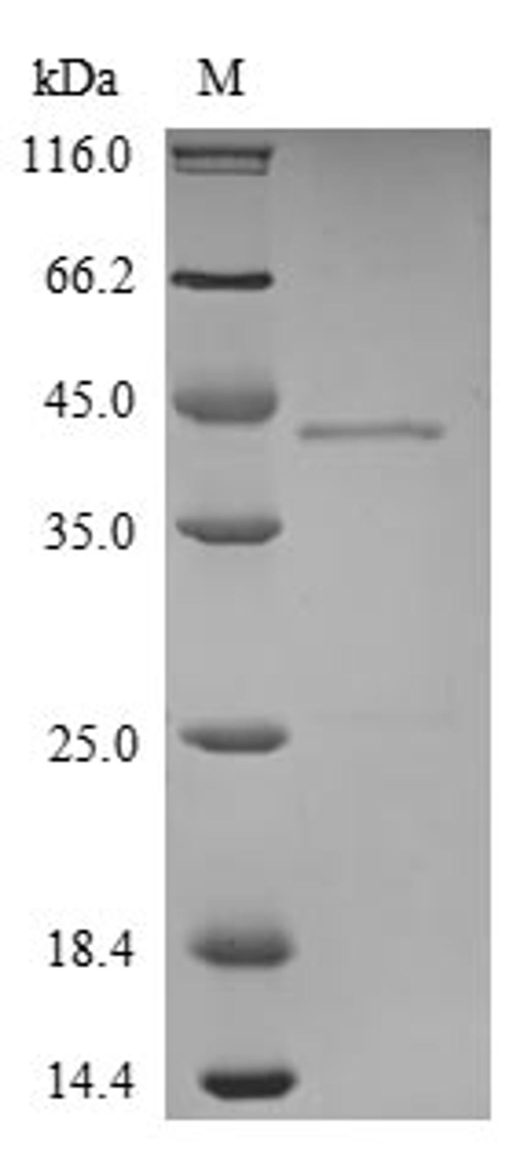 (Tris-Glycine gel) Discontinuous SDS-PAGE (reduced) with 5% enrichment gel and 15% separation gel.
