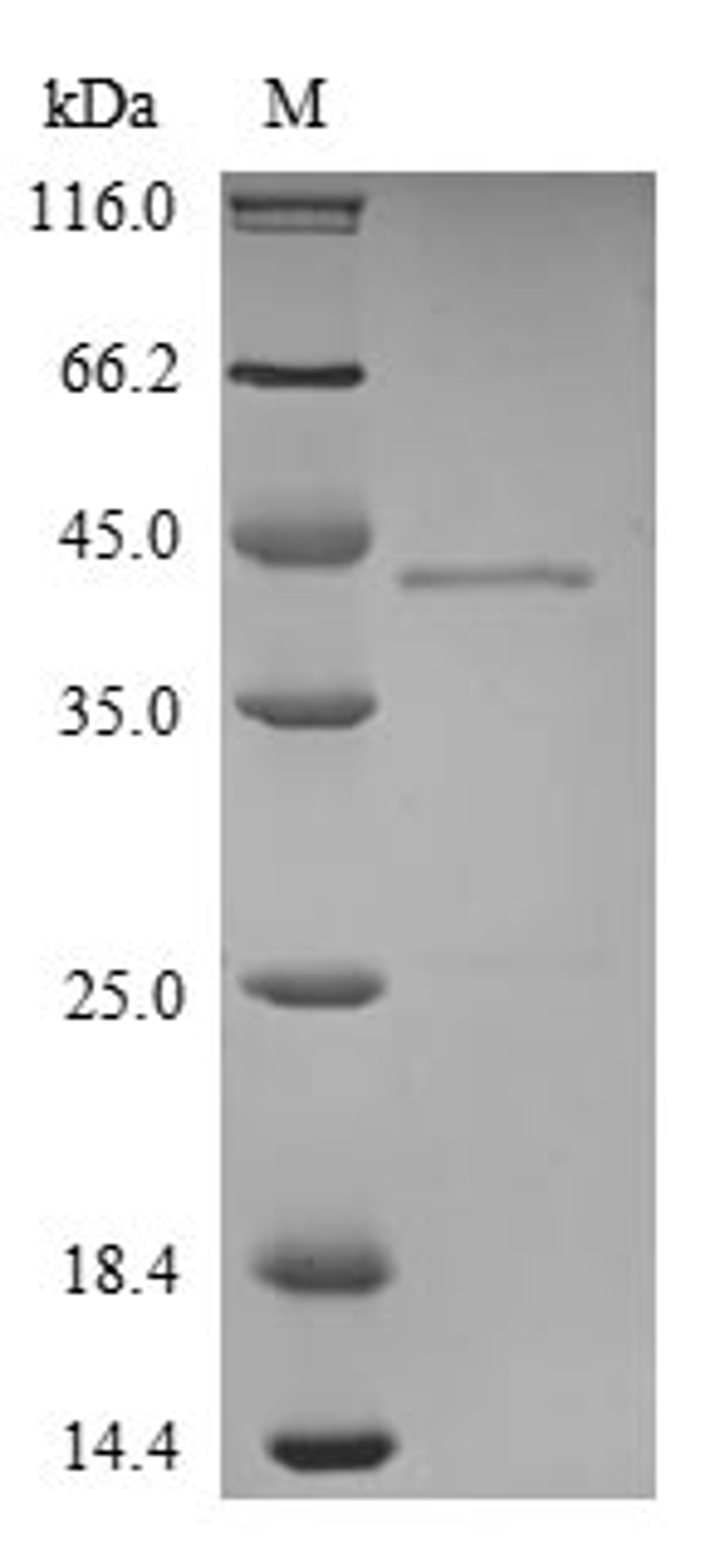 (Tris-Glycine gel) Discontinuous SDS-PAGE (reduced) with 5% enrichment gel and 15% separation gel.