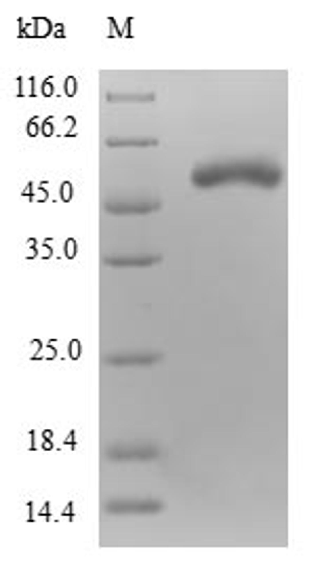 (Tris-Glycine gel) Discontinuous SDS-PAGE (reduced) with 5% enrichment gel and 15% separation gel.