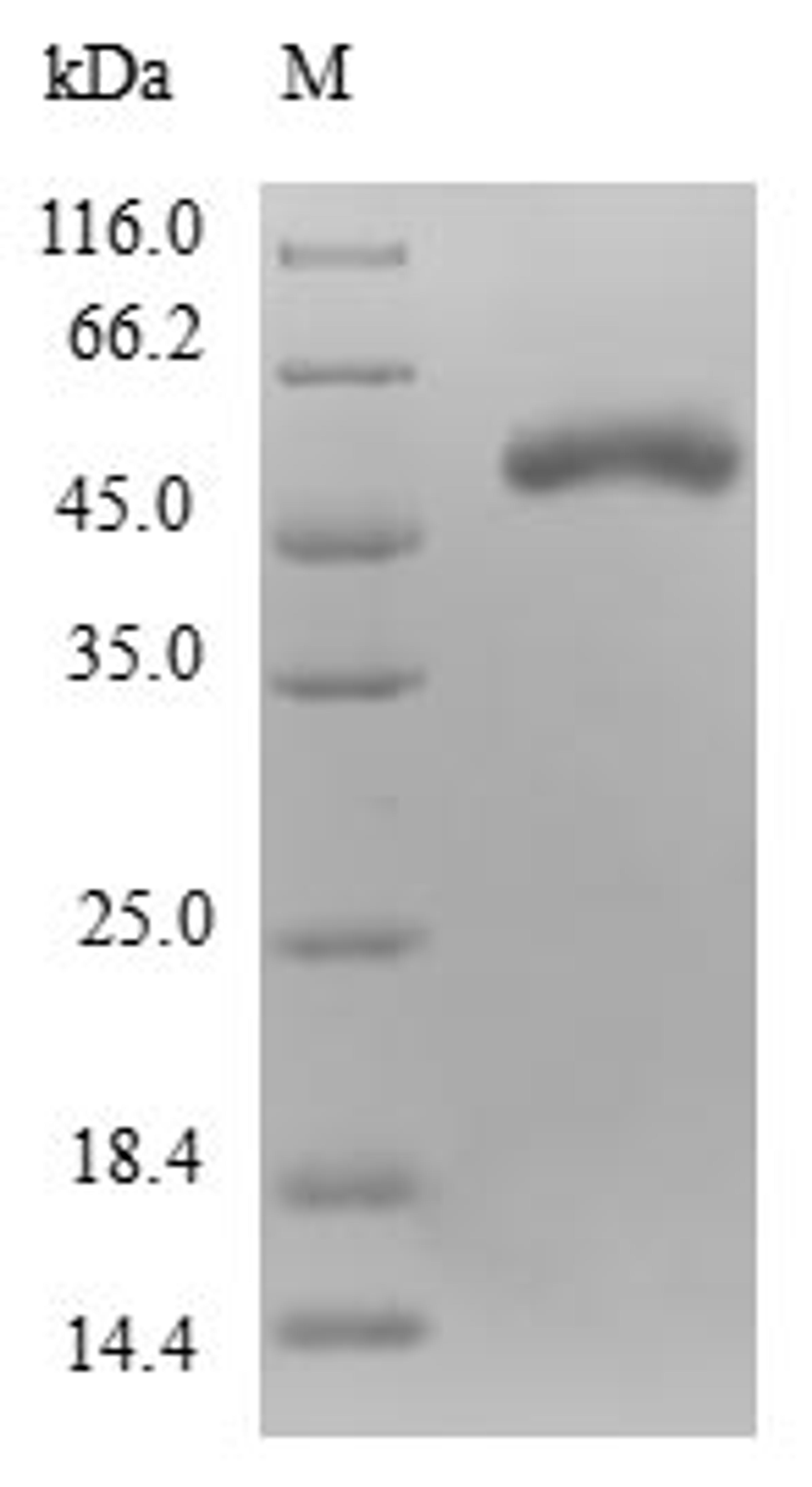 (Tris-Glycine gel) Discontinuous SDS-PAGE (reduced) with 5% enrichment gel and 15% separation gel.