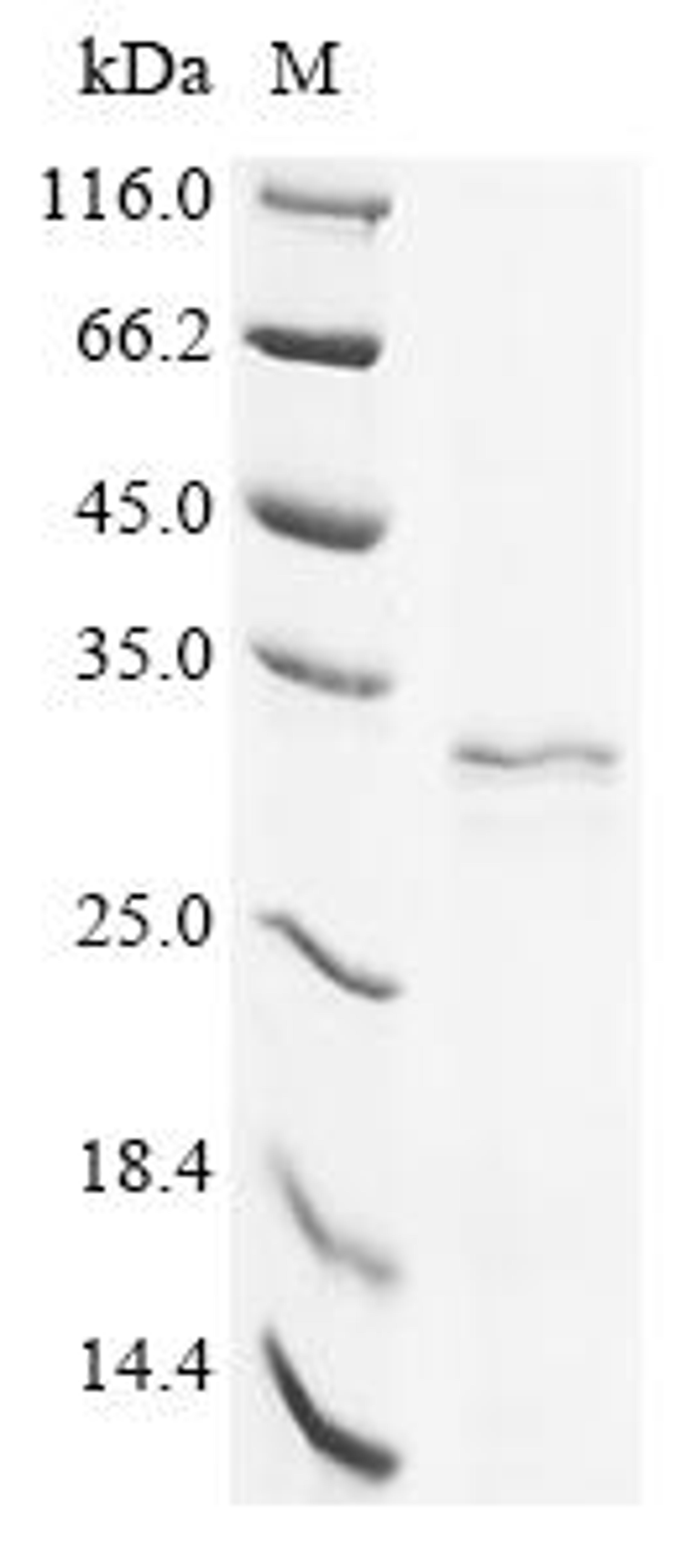 (Tris-Glycine gel) Discontinuous SDS-PAGE (reduced) with 5% enrichment gel and 15% separation gel.