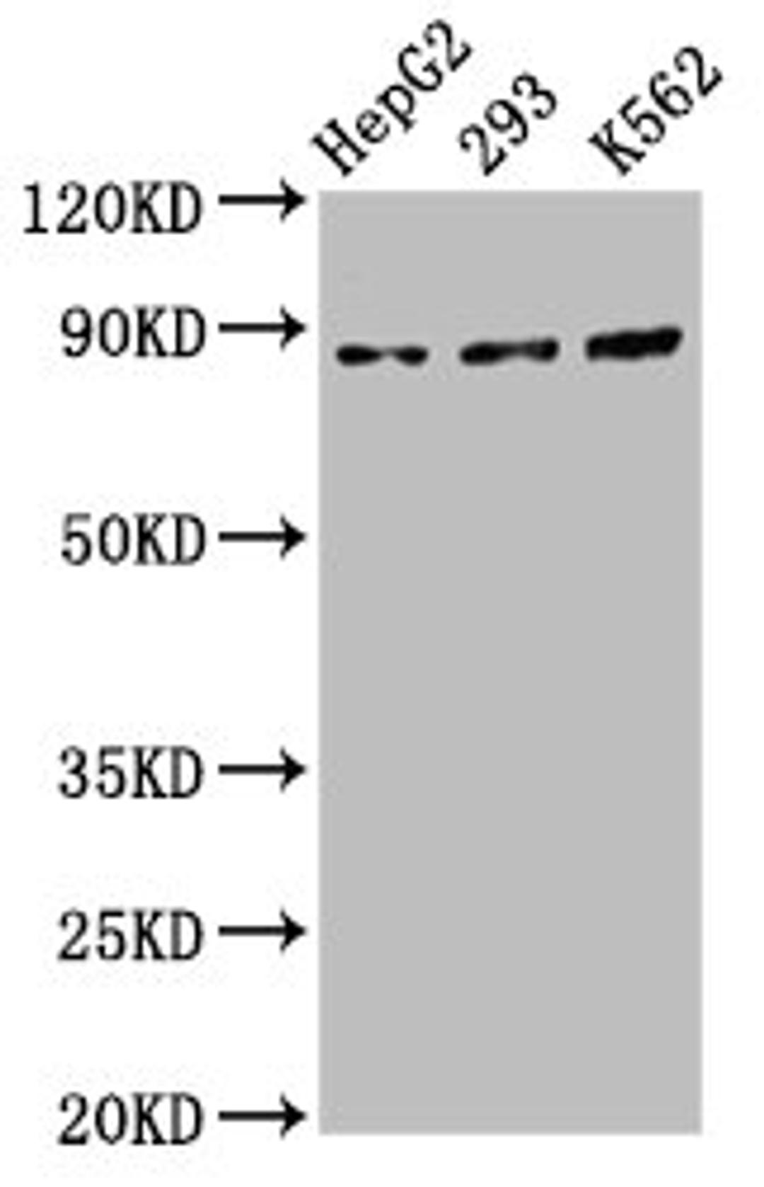 Western Blot. Positive WB detected in: HepG2 whole cell lysate, 293 whole cell lysate, K562 whole cell lysate. All lanes: CDH7 antibody at 5.5µg/ml. Secondary. Goat polyclonal to rabbit IgG at 1/50000 dilution. Predicted band size: 88 kDa. Observed band size: 88 kDa