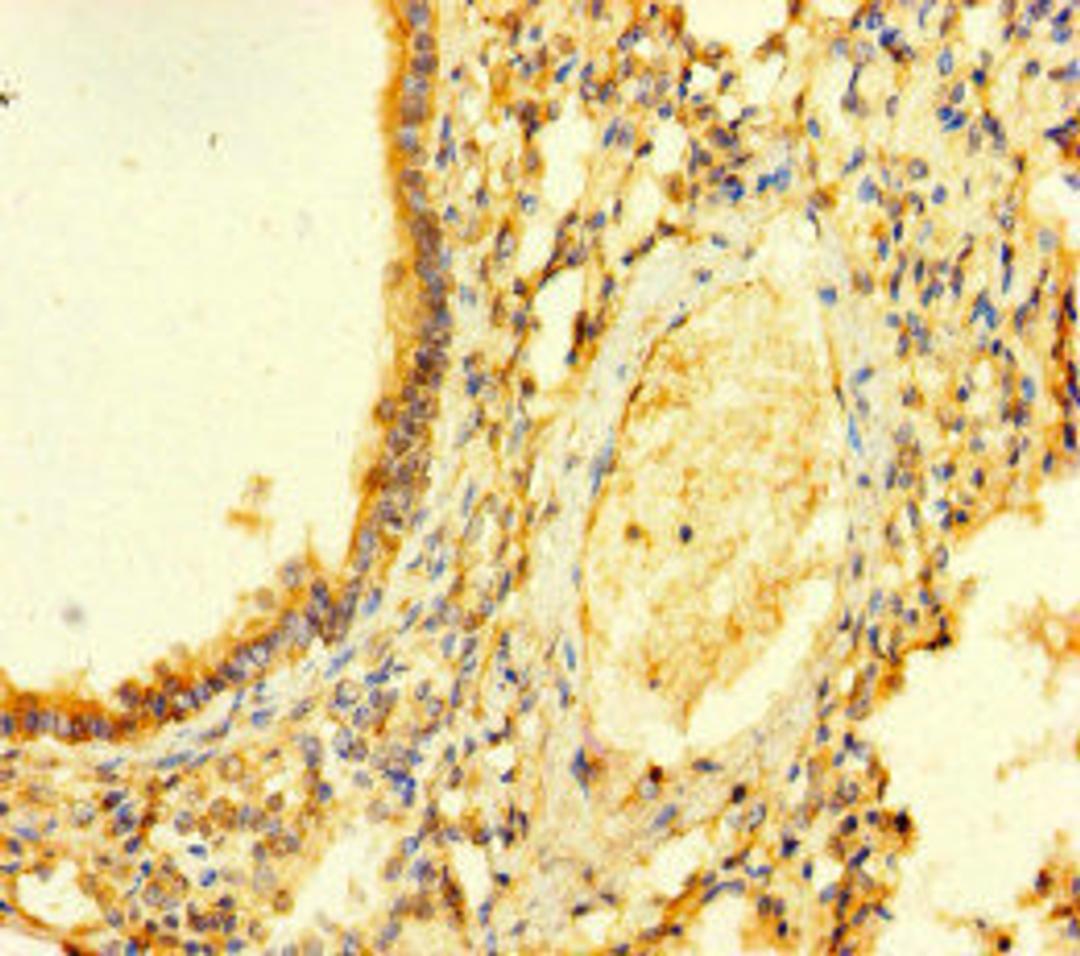 Immunohistochemistry of paraffin-embedded human lung tissue using CSB-PA757939LA01HU at dilution of 1:100
