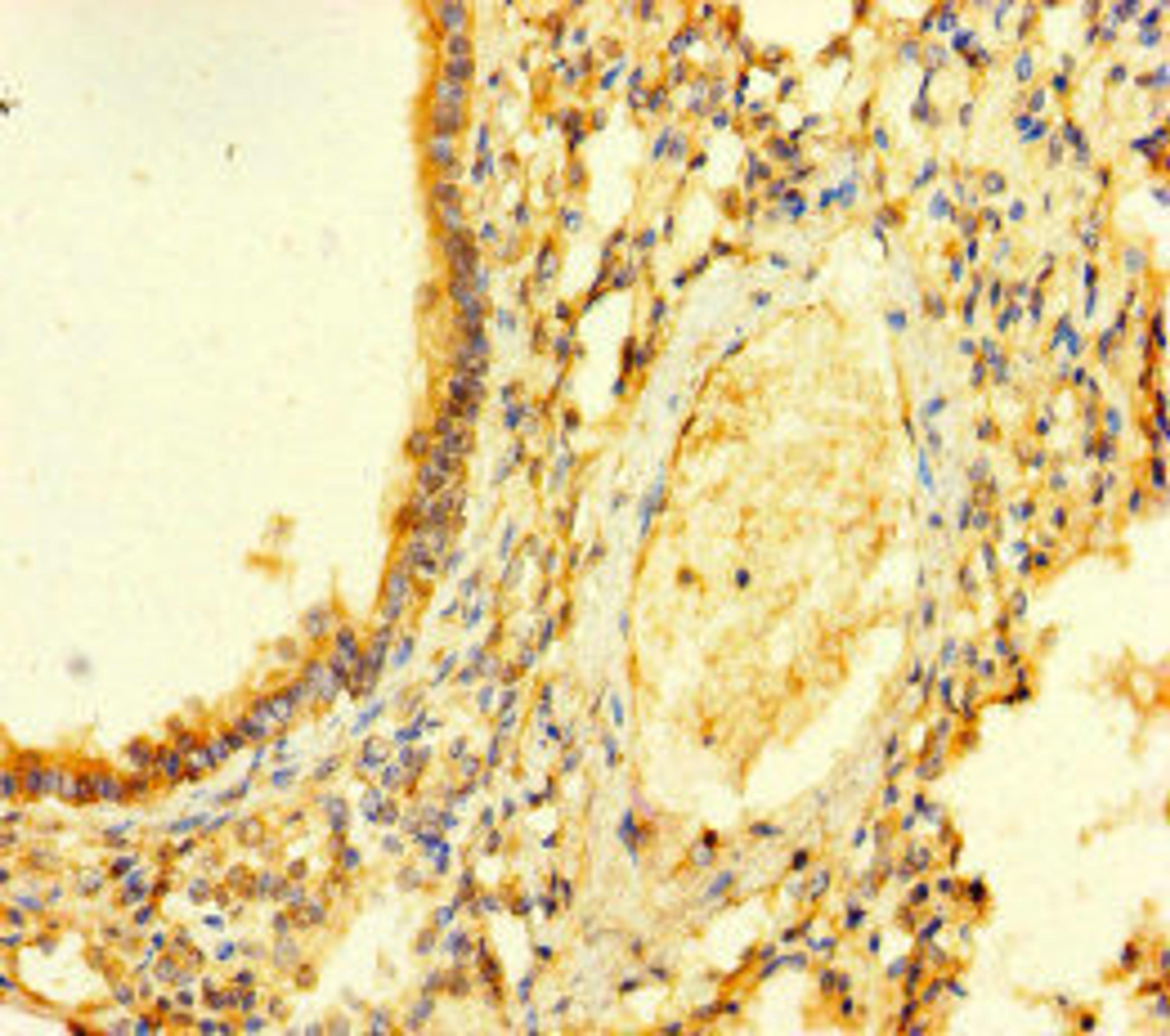 Immunohistochemistry of paraffin-embedded human lung tissue using CSB-PA757939LA01HU at dilution of 1:100