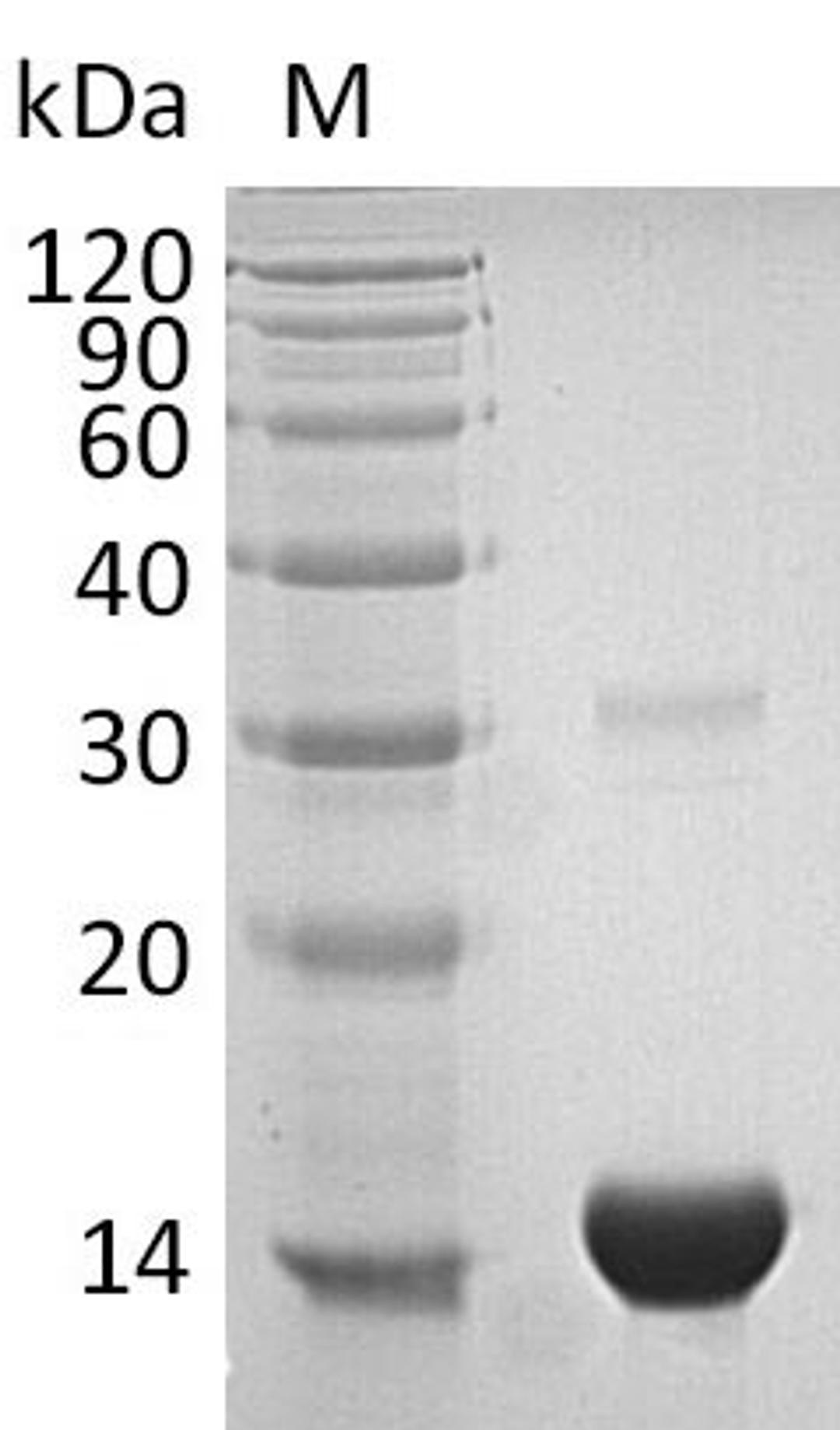 (Tris-Glycine gel) Discontinuous SDS-PAGE (reduced) with 5% enrichment gel and 15% separation gel.