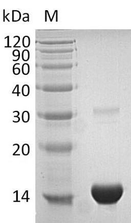 (Tris-Glycine gel) Discontinuous SDS-PAGE (reduced) with 5% enrichment gel and 15% separation gel.