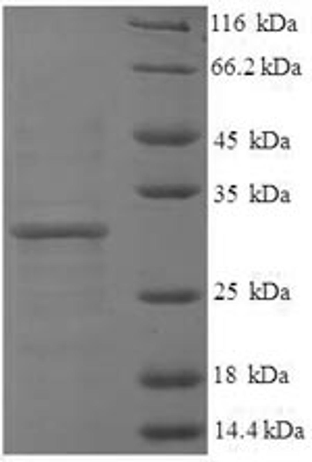 (Tris-Glycine gel) Discontinuous SDS-PAGE (reduced) with 5% enrichment gel and 15% separation gel.