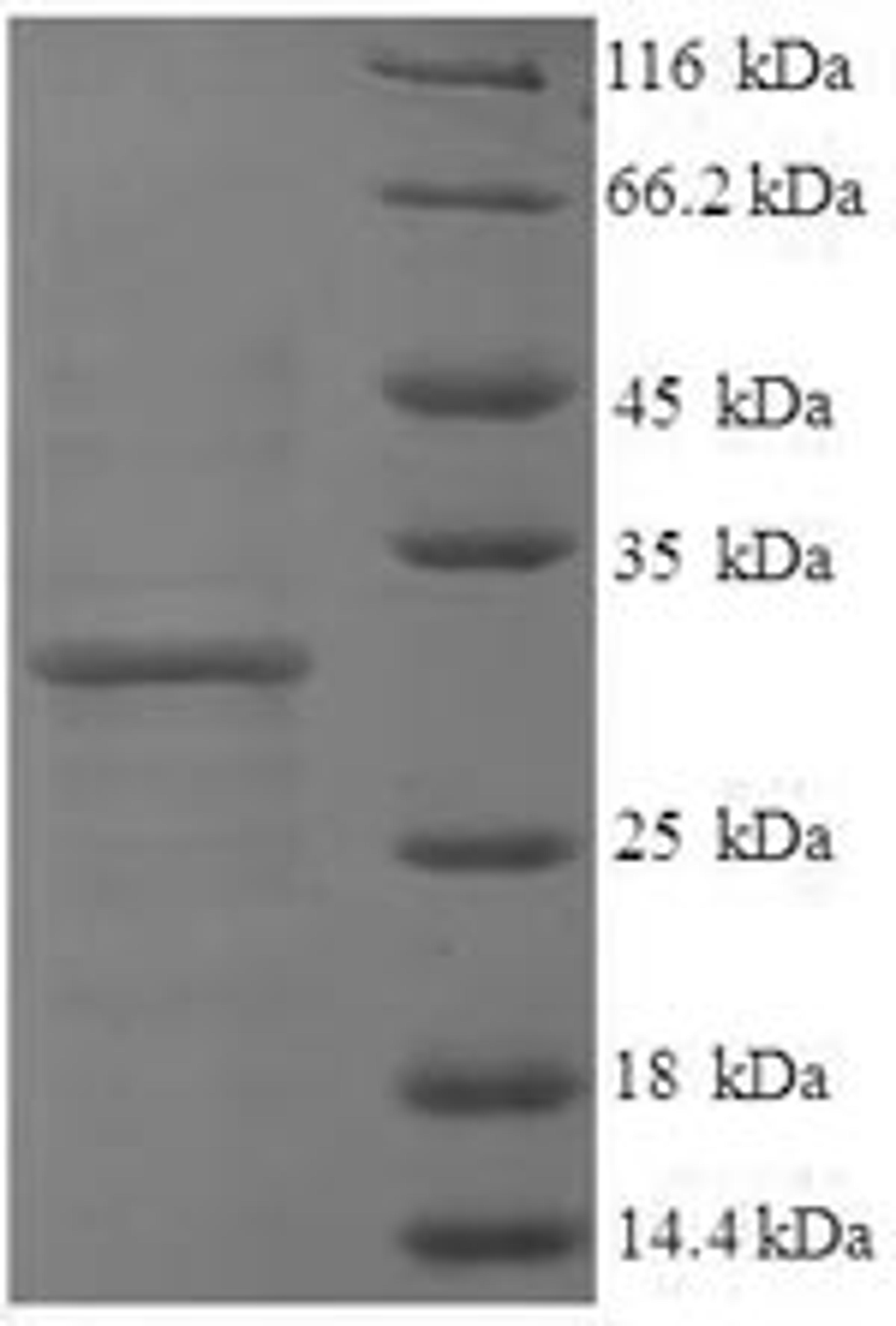 (Tris-Glycine gel) Discontinuous SDS-PAGE (reduced) with 5% enrichment gel and 15% separation gel.