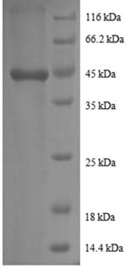 (Tris-Glycine gel) Discontinuous SDS-PAGE (reduced) with 5% enrichment gel and 15% separation gel.