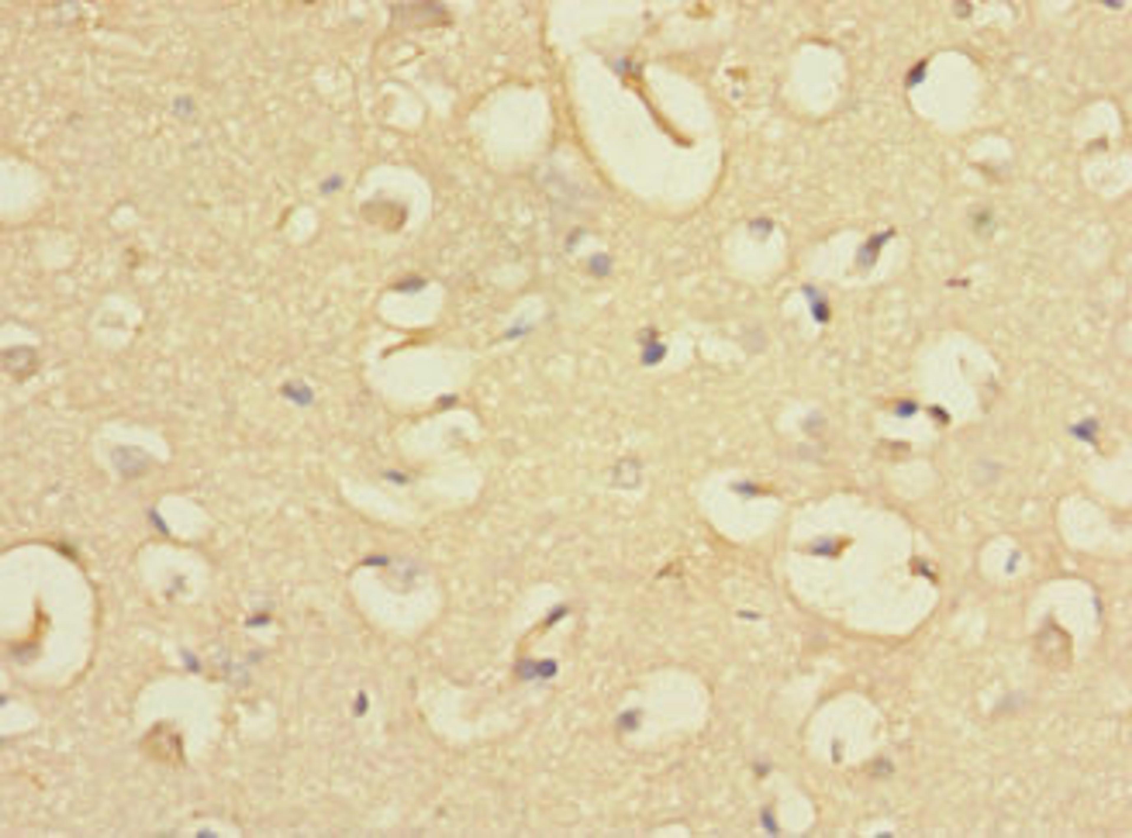 Immunohistochemistry of paraffin-embedded human brain tissue using CSB-PA007865LA01HU at dilution of 1:100