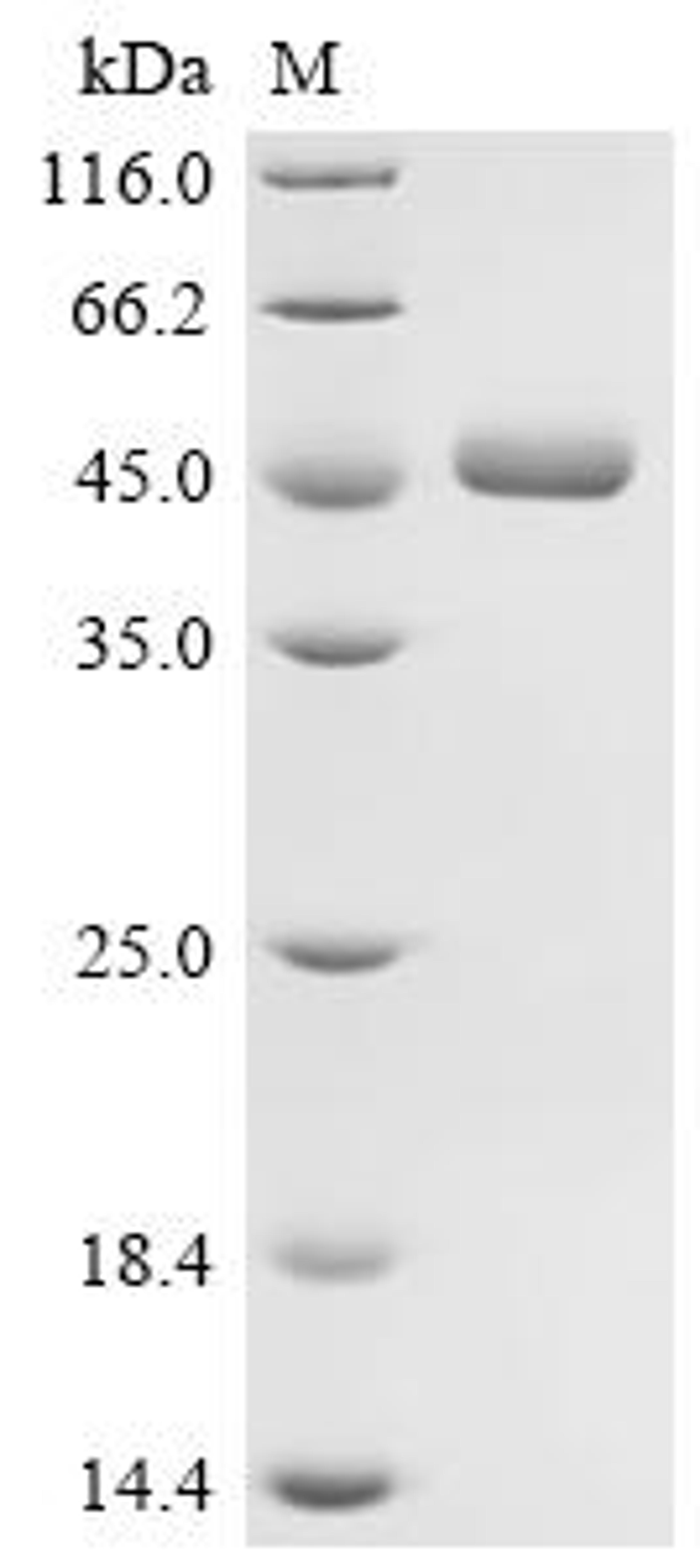 (Tris-Glycine gel) Discontinuous SDS-PAGE (reduced) with 5% enrichment gel and 15% separation gel.