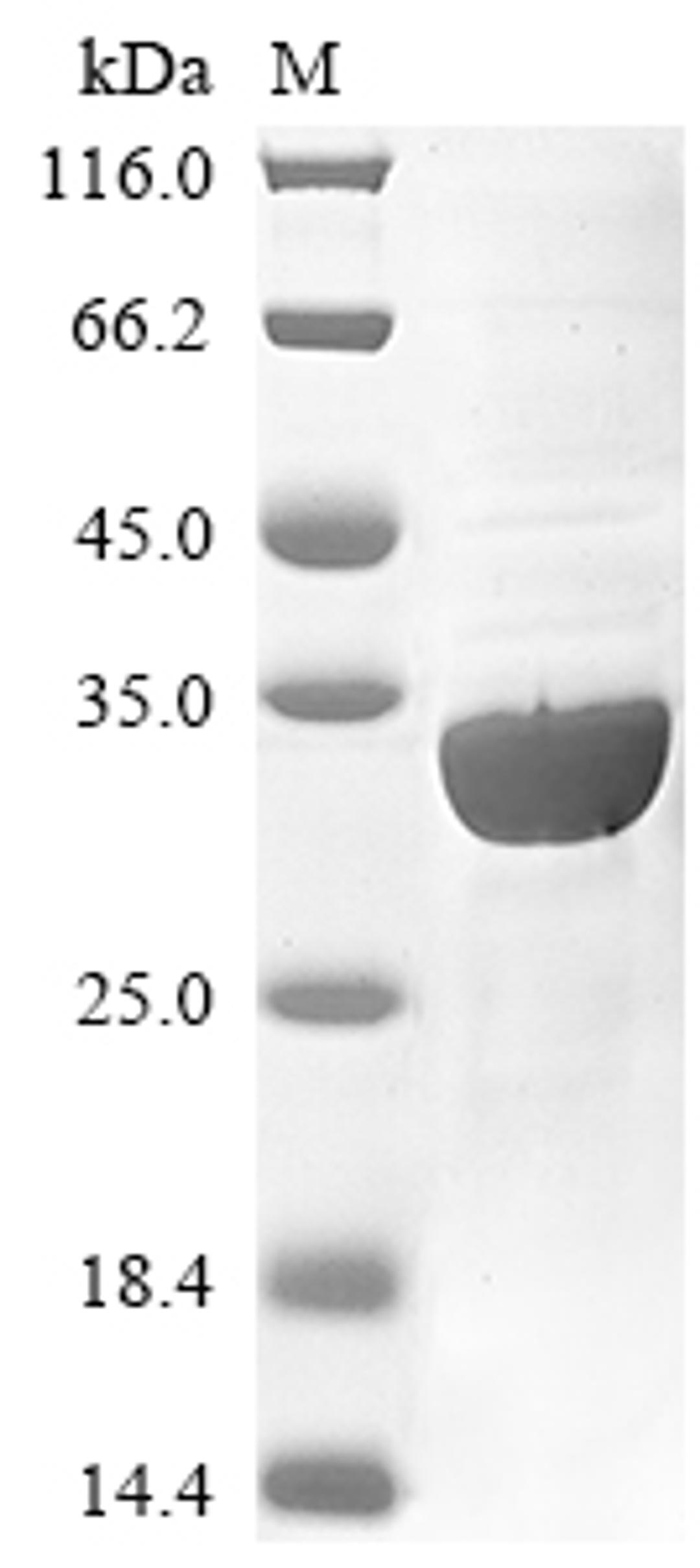 (Tris-Glycine gel) Discontinuous SDS-PAGE (reduced) with 5% enrichment gel and 15% separation gel.