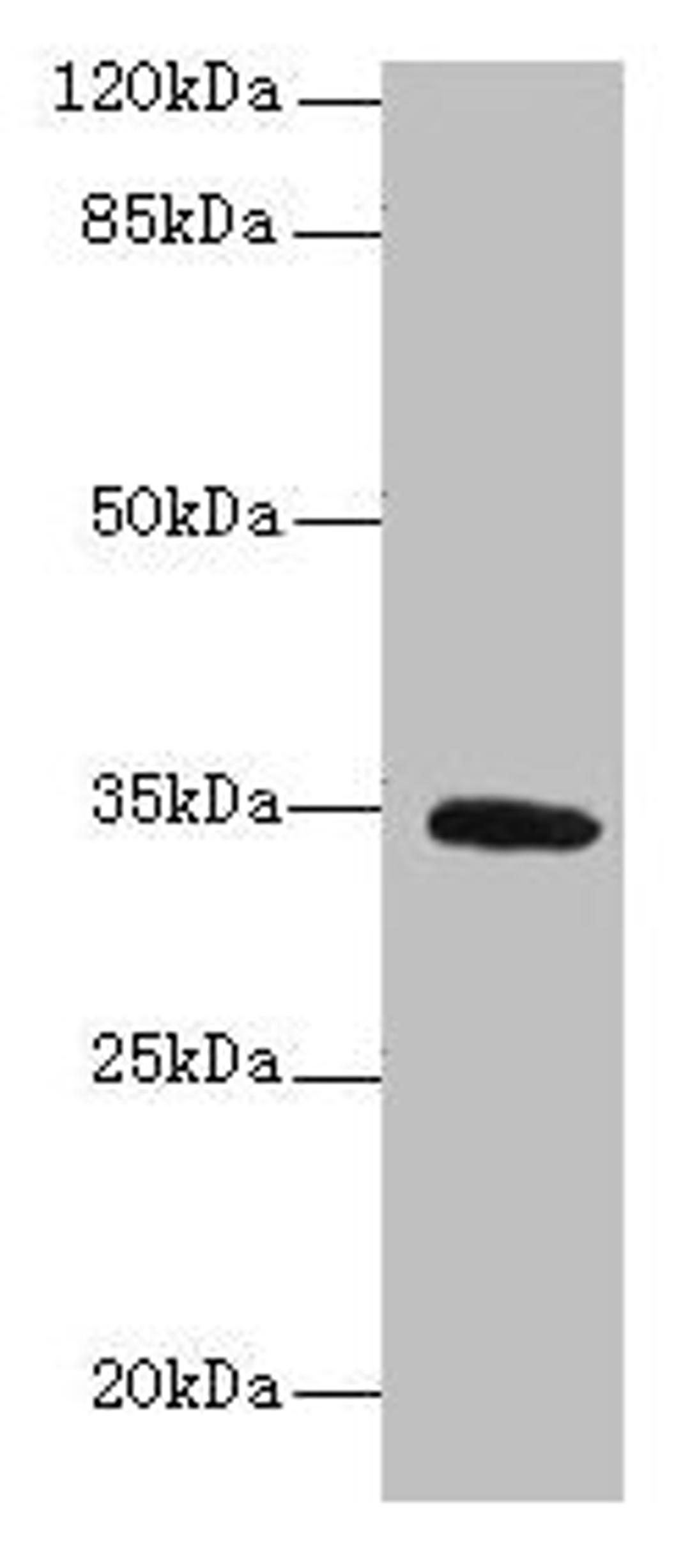 Western blot. All lanes: SETD9 antibody at 6µg/ml + K562 whole cell lysate. Secondary. Goat polyclonal to rabbit IgG at 1/10000 dilution. Predicted band size: 35, 31 kDa. Observed band size: 35 kDa