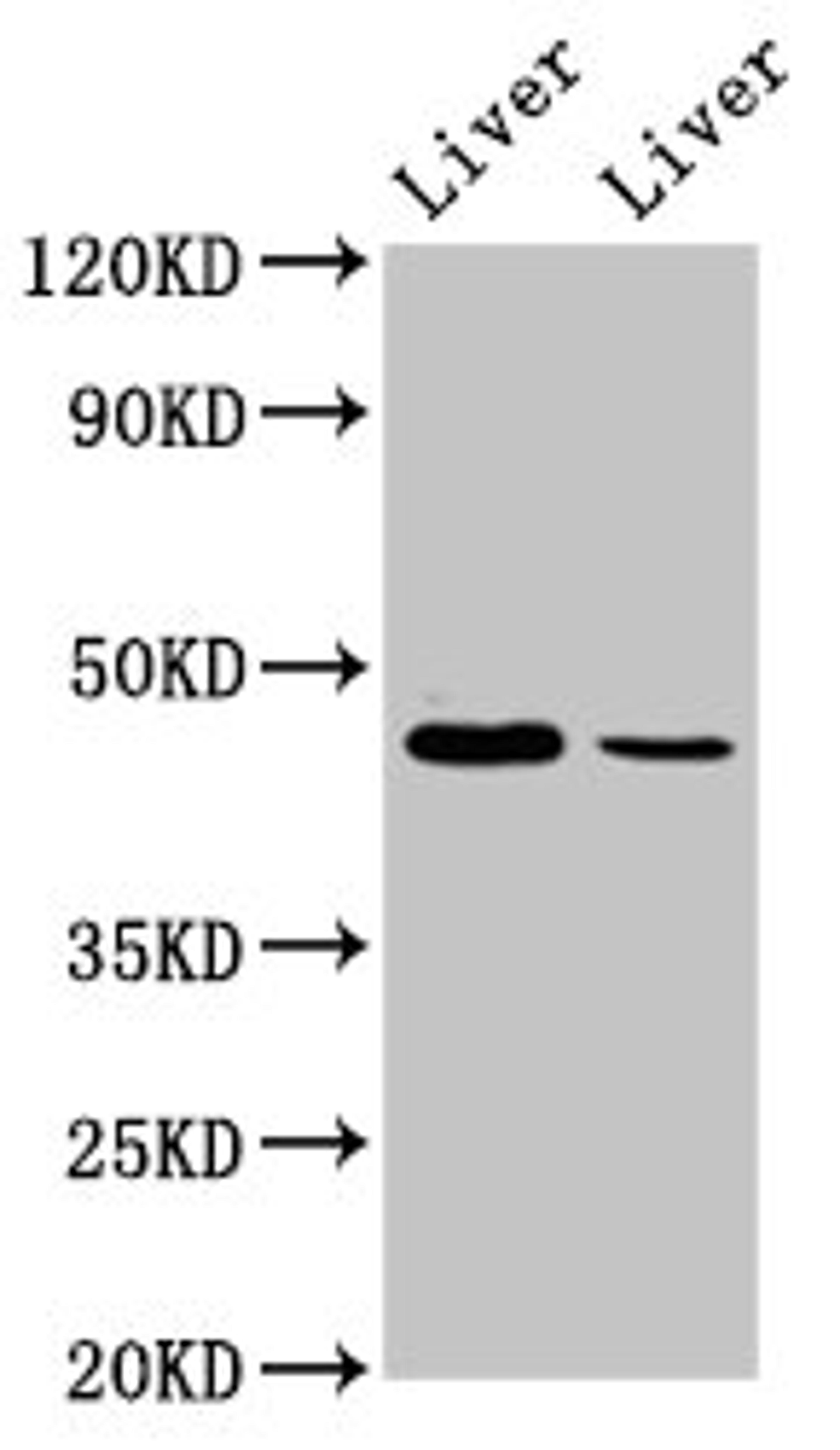 Western Blot. Positive WB detected in: Mouse liver tissue, Rat liver tissue. All lanes: DDB2 antibody at 4.9ug/ml. Secondary. Goat polyclonal to rabbit IgG at 1/50000 dilution. Predicted band size: 48, 27, 18, 41 kDa. Observed band size: 48 kDa.