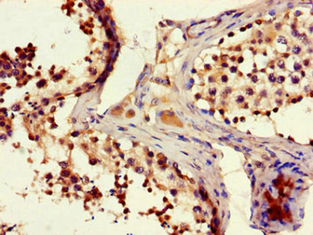 Immunohistochemistry of paraffin-embedded human testis tissue using CSB-PA735976LA01HU at dilution of 1:100