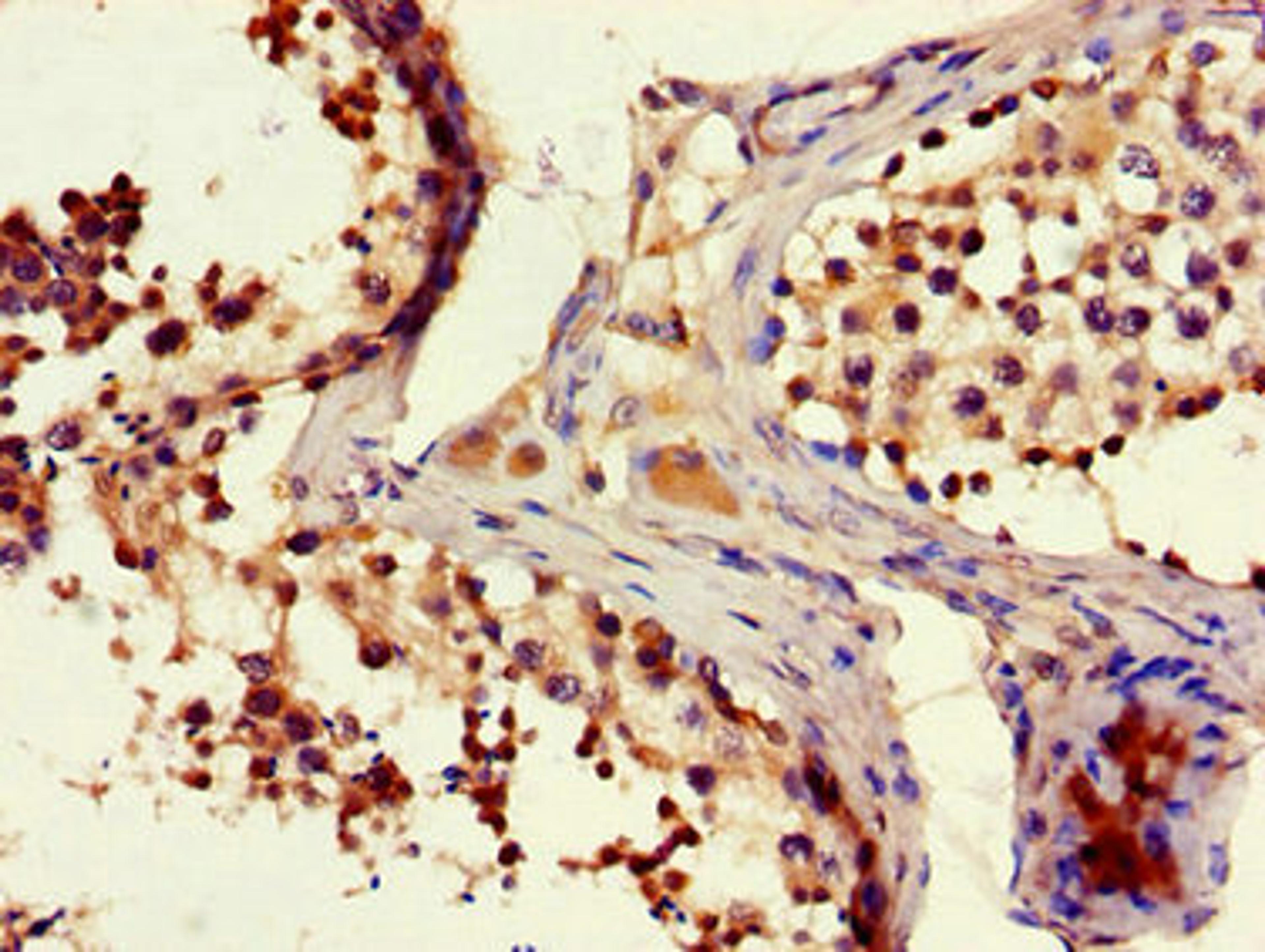 Immunohistochemistry of paraffin-embedded human testis tissue using CSB-PA735976LA01HU at dilution of 1:100