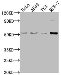 Western Blot. Positive WB detected in: Hela whole cell lysate, A549 whole cell lysate, PC-3 whole cell lysate, MCF-7 whole cell lysate. All lanes: FKTN antibody at 1:2000. Secondary. Goat polyclonal to rabbit IgG at 1/50000 dilution. Predicted band size: 54, 50 kDa. Observed band size: 54 kDa