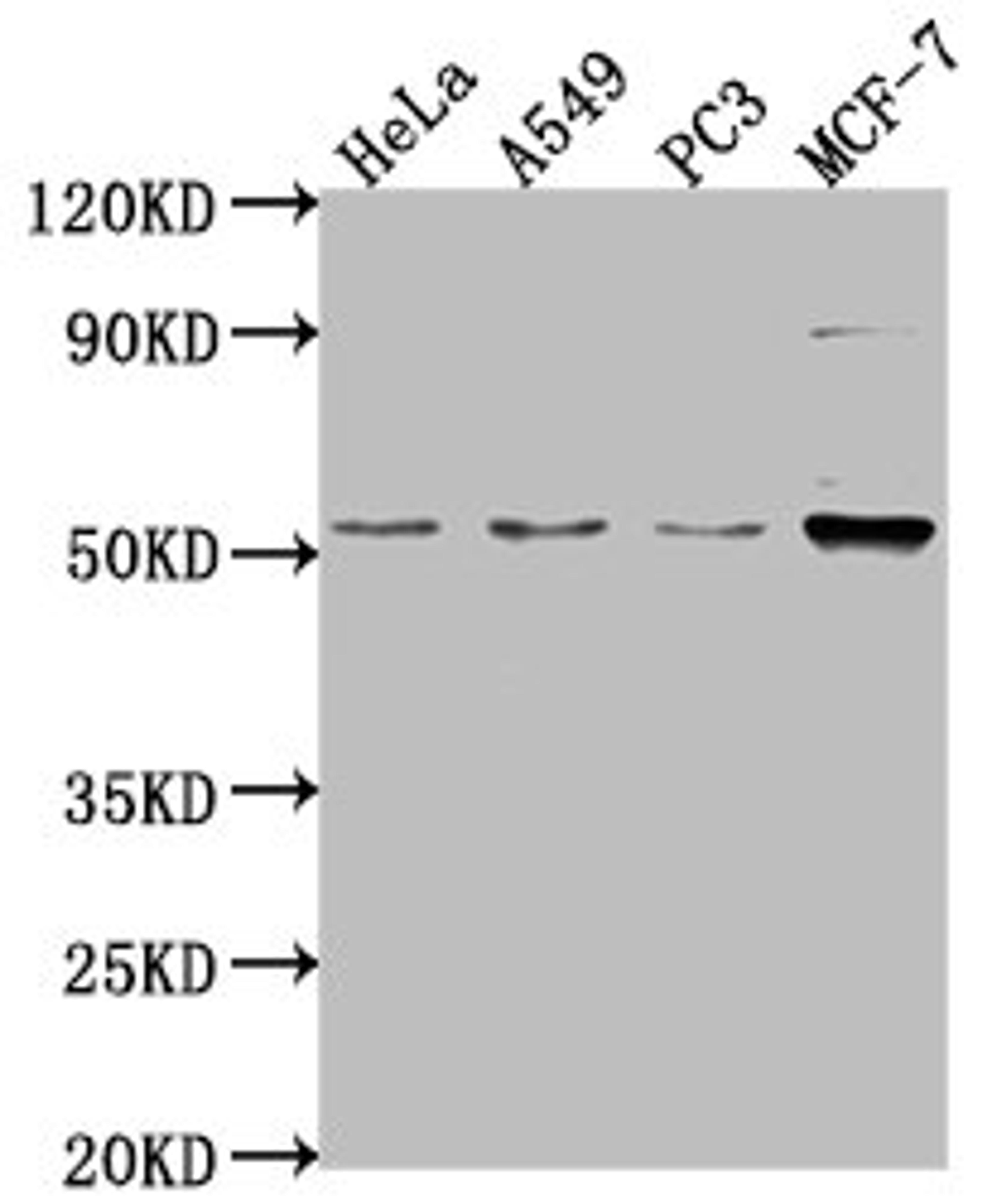 Western Blot. Positive WB detected in: Hela whole cell lysate, A549 whole cell lysate, PC-3 whole cell lysate, MCF-7 whole cell lysate. All lanes: FKTN antibody at 1:2000. Secondary. Goat polyclonal to rabbit IgG at 1/50000 dilution. Predicted band size: 54, 50 kDa. Observed band size: 54 kDa