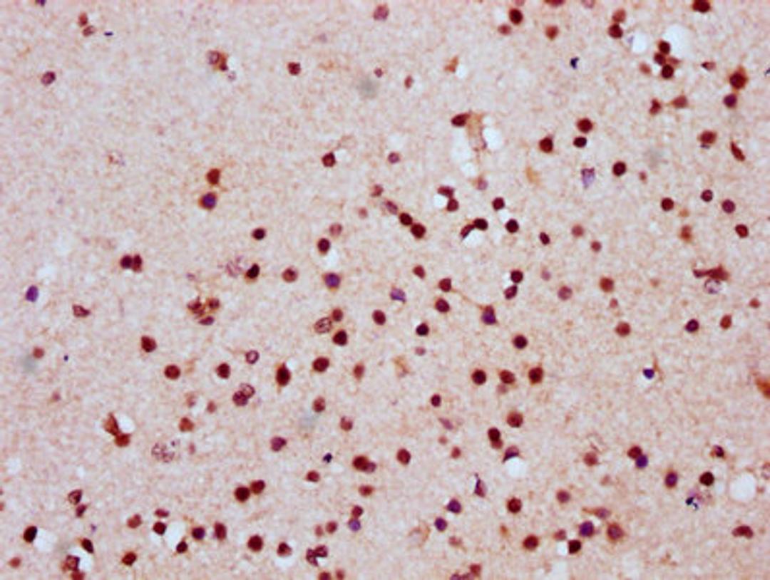 IHC image of CSB-PA010389OA118nhibHU diluted at 1:20 and staining in paraffin-embedded human brain tissue performed on a Leica BondTM system. After dewaxing and hydration, antigen retrieval was mediated by high pressure in a citrate buffer (pH 6.0). Section was blocked with 10% normal goat serum 30min at RT. Then primary antibody (1% BSA) was incubated at 4°C overnight. The primary is detected by a biotinylated secondary antibody and visualized using an HRP conjugated SP system.