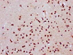 IHC image of CSB-PA010389OA118nhibHU diluted at 1:20 and staining in paraffin-embedded human brain tissue performed on a Leica BondTM system. After dewaxing and hydration, antigen retrieval was mediated by high pressure in a citrate buffer (pH 6.0). Section was blocked with 10% normal goat serum 30min at RT. Then primary antibody (1% BSA) was incubated at 4°C overnight. The primary is detected by a biotinylated secondary antibody and visualized using an HRP conjugated SP system.