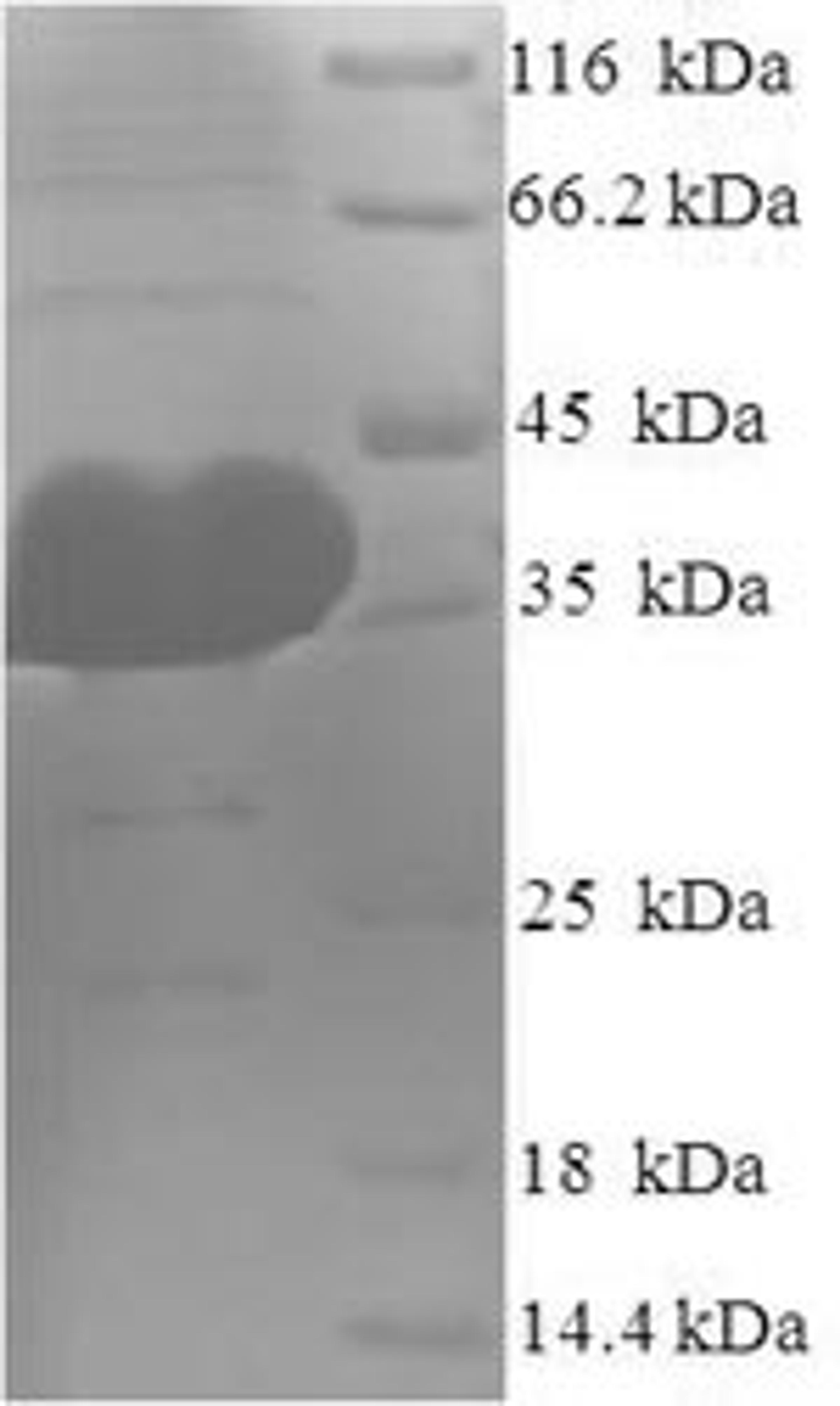 (Tris-Glycine gel) Discontinuous SDS-PAGE (reduced) with 5% enrichment gel and 15% separation gel.