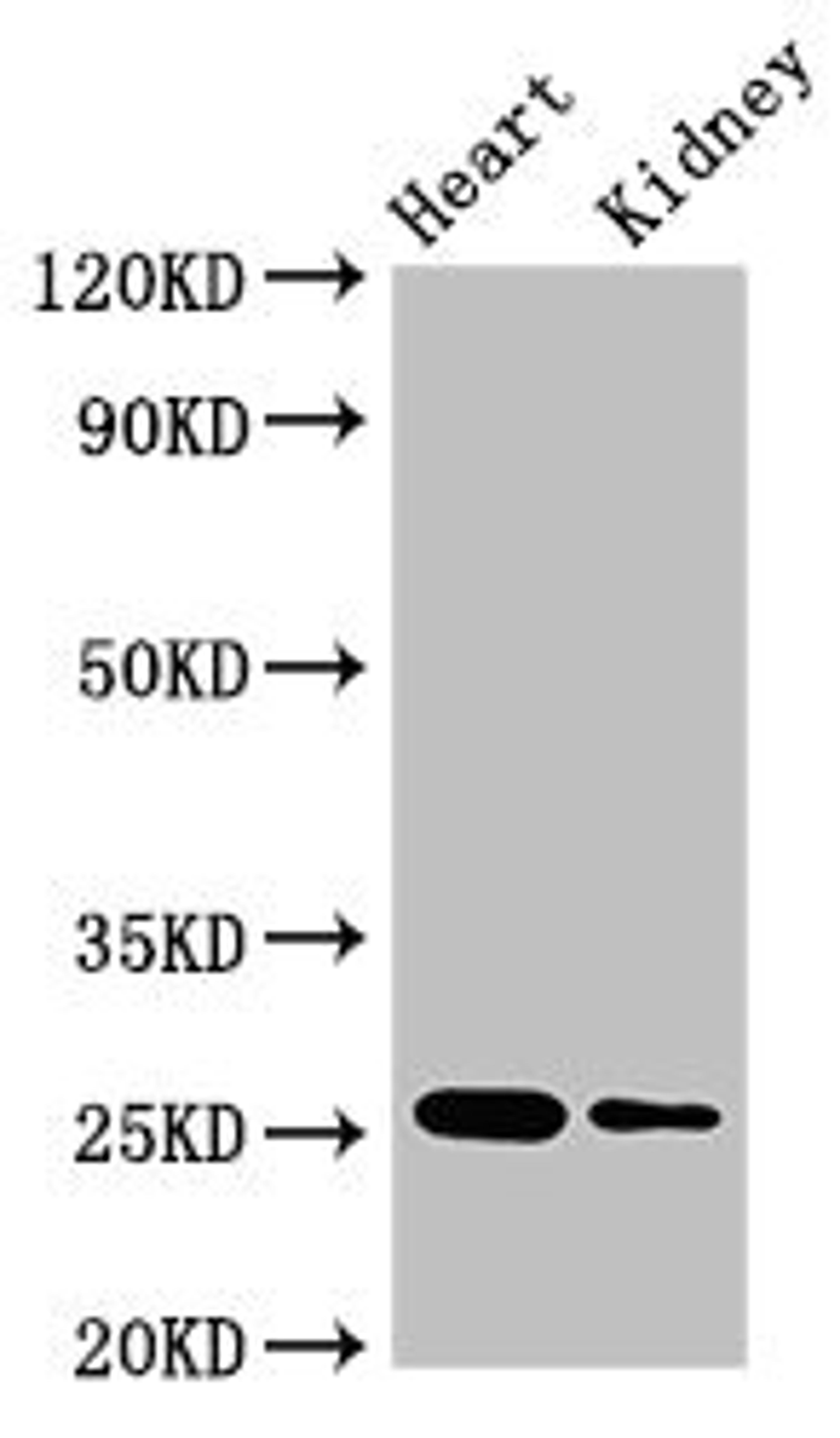Western Blot. Positive WB detected in: Mouse heart tissue, Mouse kidney tissue. All lanes: CSH2 antibody at 4ug/ml. Secondary. Goat polyclonal to rabbit IgG at 1/50000 dilution. Predicted band size: 25, 19, 14 kDa. Observed band size: 25 kDa. 