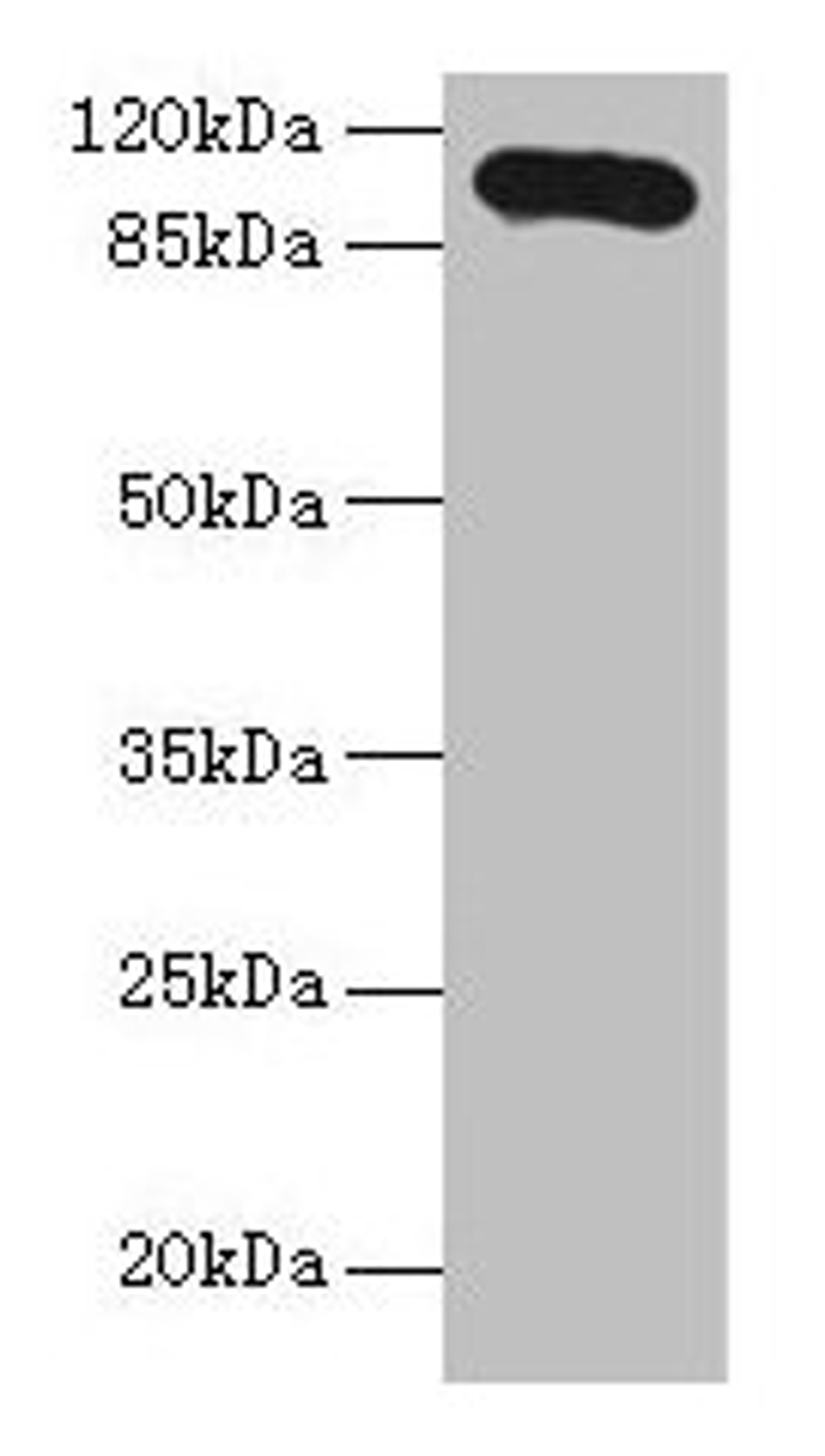 Western blot. All lanes: Thbs3 antibody at 16µg/ml + HepG2 whole cell lysate. Secondary. Goat polyclonal to rabbit IgG at 1/10000 dilution. Predicted band size: 105 kDa. Observed band size: 105 kDa