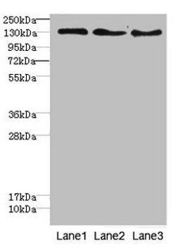 Western blot. All lanes: RBP2antibody at 1.76ug/ml. Lane 1: Hela whole cell lysate. Lane 2: HepG2 whole cell lysate. Lane 3: Jurkat whole cell lysate. Secondary. Goat polyclonal to rabbit IgG at 1/10000 dilution. Predicted band size: 192 kDa. Observed band size: 192 kDa. 