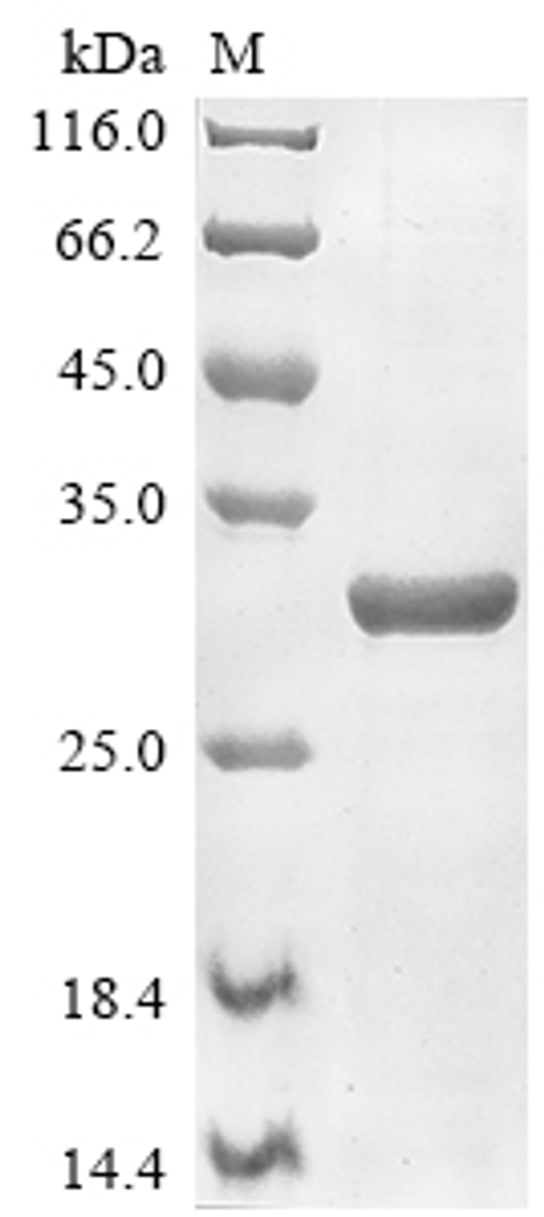 (Tris-Glycine gel) Discontinuous SDS-PAGE (reduced) with 5% enrichment gel and 15% separation gel.
