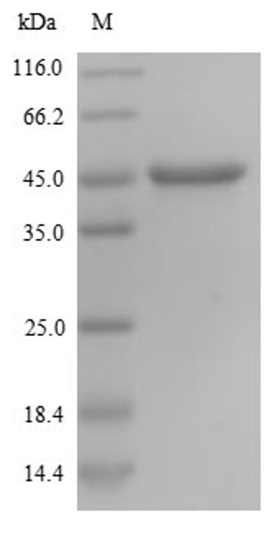 (Tris-Glycine gel) Discontinuous SDS-PAGE (reduced) with 5% enrichment gel and 15% separation gel.