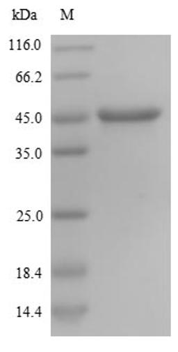 (Tris-Glycine gel) Discontinuous SDS-PAGE (reduced) with 5% enrichment gel and 15% separation gel.