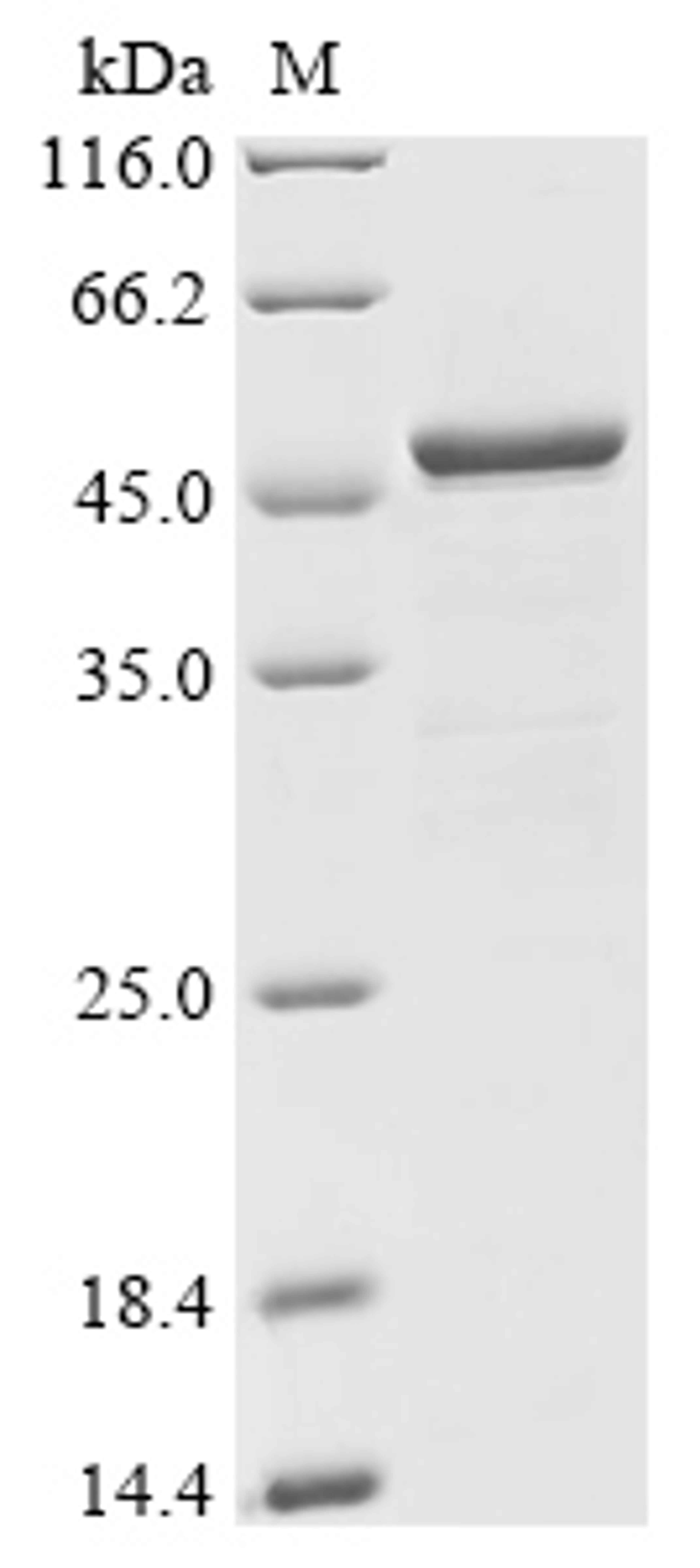 (Tris-Glycine gel) Discontinuous SDS-PAGE (reduced) with 5% enrichment gel and 15% separation gel.