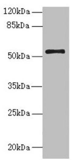 Western blot. All lanes: NLE1 antibody at 1.48µg/ml + PC-3 whole cell lysate. Secondary. Goat polyclonal to rabbit IgG at 1/10000 dilution. Predicted band size: 54, 22 kDa. Observed band size: 54 kDa