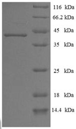 (Tris-Glycine gel) Discontinuous SDS-PAGE (reduced) with 5% enrichment gel and 15% separation gel.