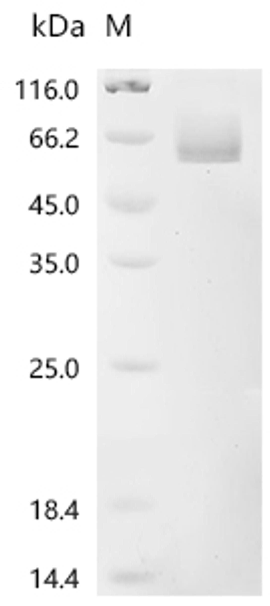 (Tris-Glycine gel) Discontinuous SDS-PAGE (reduced) with 5% enrichment gel and 15% separation gel.