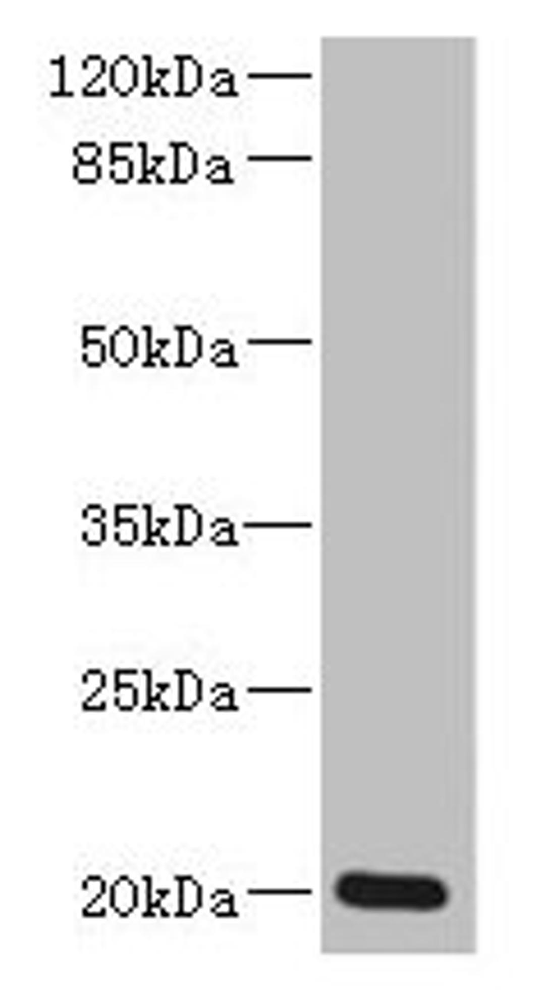 Western blot. All lanes: ZMAT5 antibody at 5µg/ml + Colo320 whole cell lysate. Secondary. Goat polyclonal to rabbit IgG at 1/10000 dilution. Predicted band size: 20 kDa. Observed band size: 20 kDa