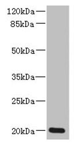 Western blot. All lanes: ZMAT5 antibody at 5µg/ml + Colo320 whole cell lysate. Secondary. Goat polyclonal to rabbit IgG at 1/10000 dilution. Predicted band size: 20 kDa. Observed band size: 20 kDa