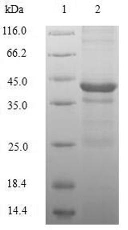 (Tris-Glycine gel) Discontinuous SDS-PAGE (reduced) with 5% enrichment gel and 15% separation gel.