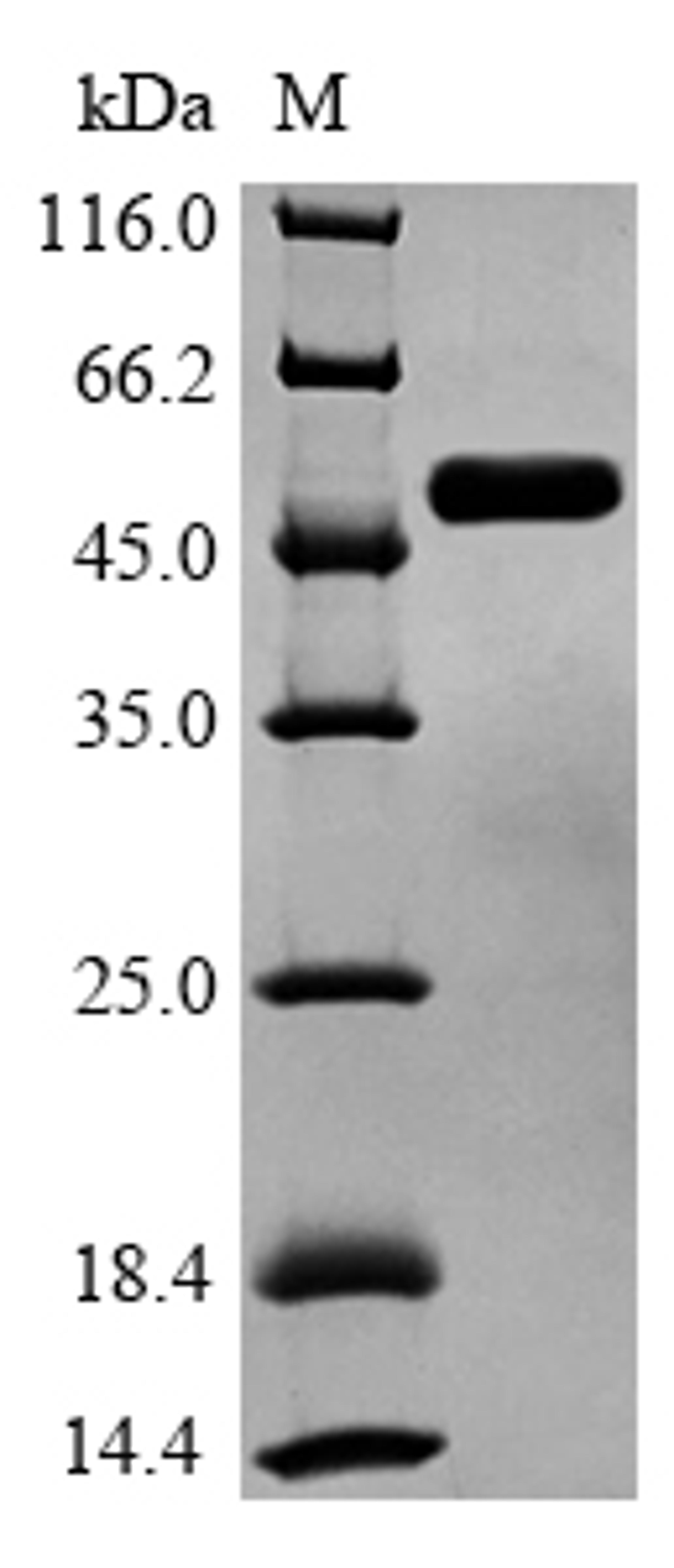 (Tris-Glycine gel) Discontinuous SDS-PAGE (reduced) with 5% enrichment gel and 15% separation gel.