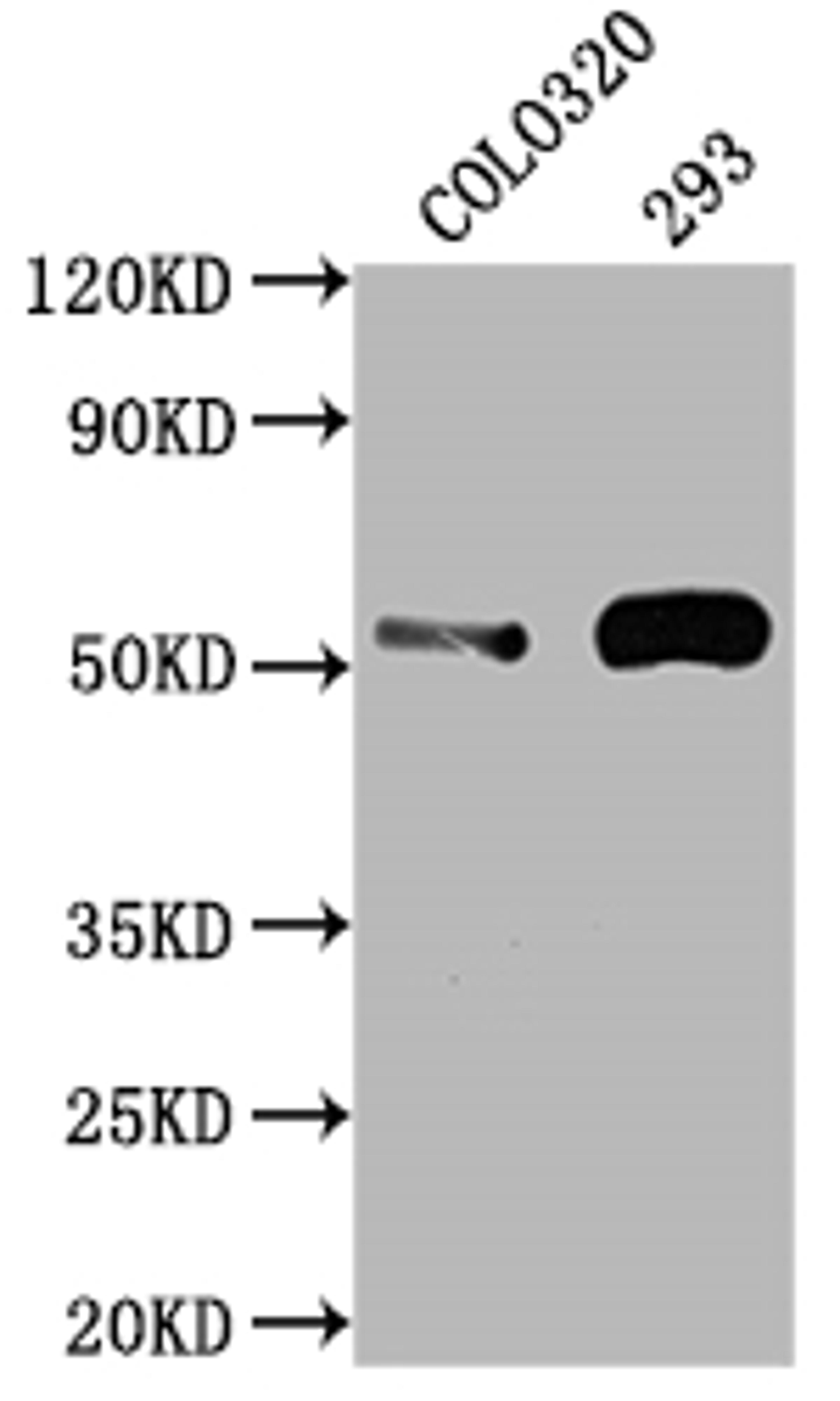 Western Blot. Positive WB detected in: COLO320 whole cell lysate, 293 whole cell lysate. All lanes: TP53 antibody at 1:2000. Secondary. Goat polyclonal to rabbit IgG at 1/50000 dilution. Predicted band size: 44, 38, 39, 40, 34, 35, 30, 24, 25 kDa. Observed band size: 53 kDa.
